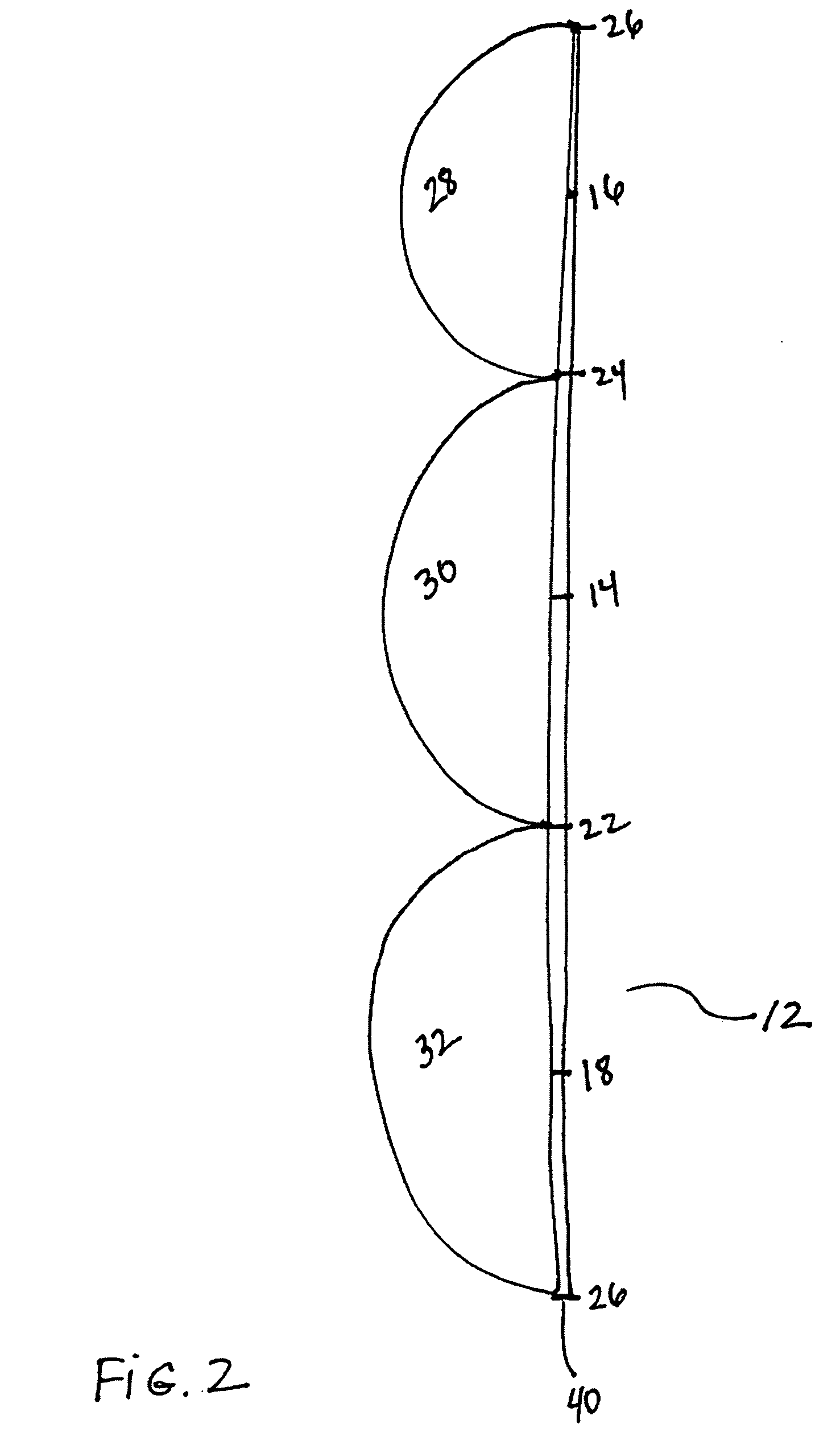 Sewing Ring for a Prosthetic Tissue Valve