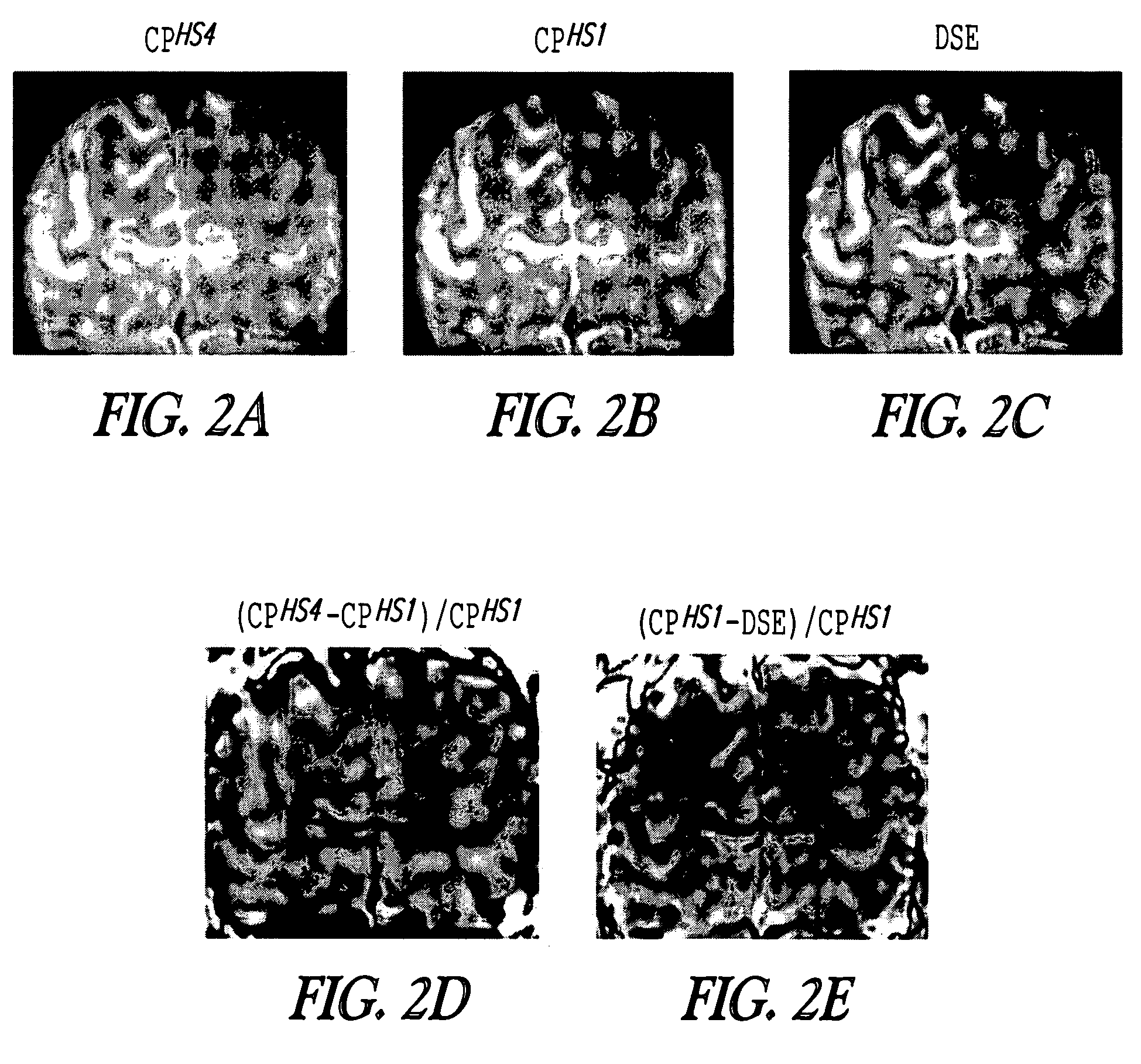 Contrast from rotating frame relaxation by adiabatic pulses