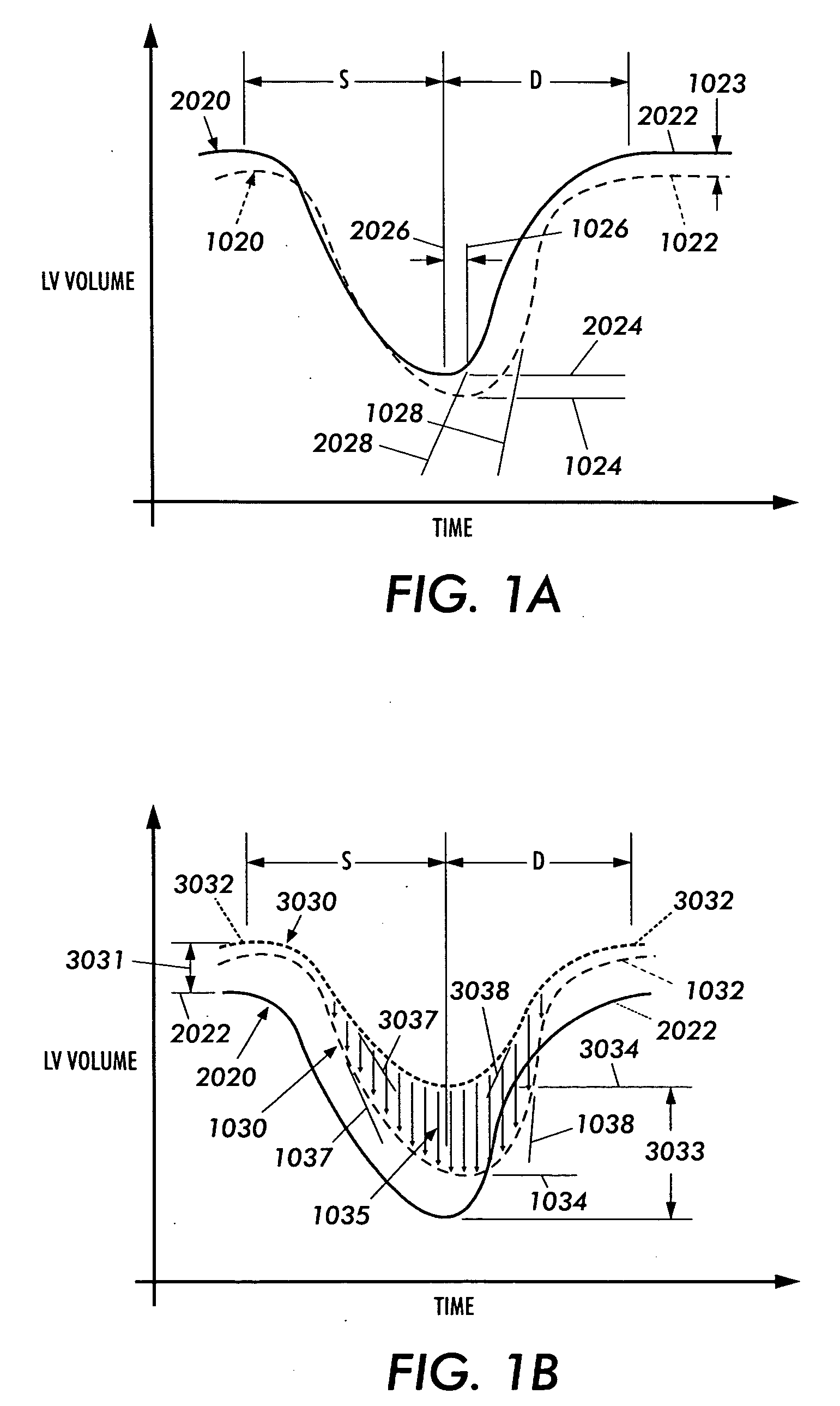 Therapeutic agent delivery apparatus with direct mechanical ventricular assistance capability