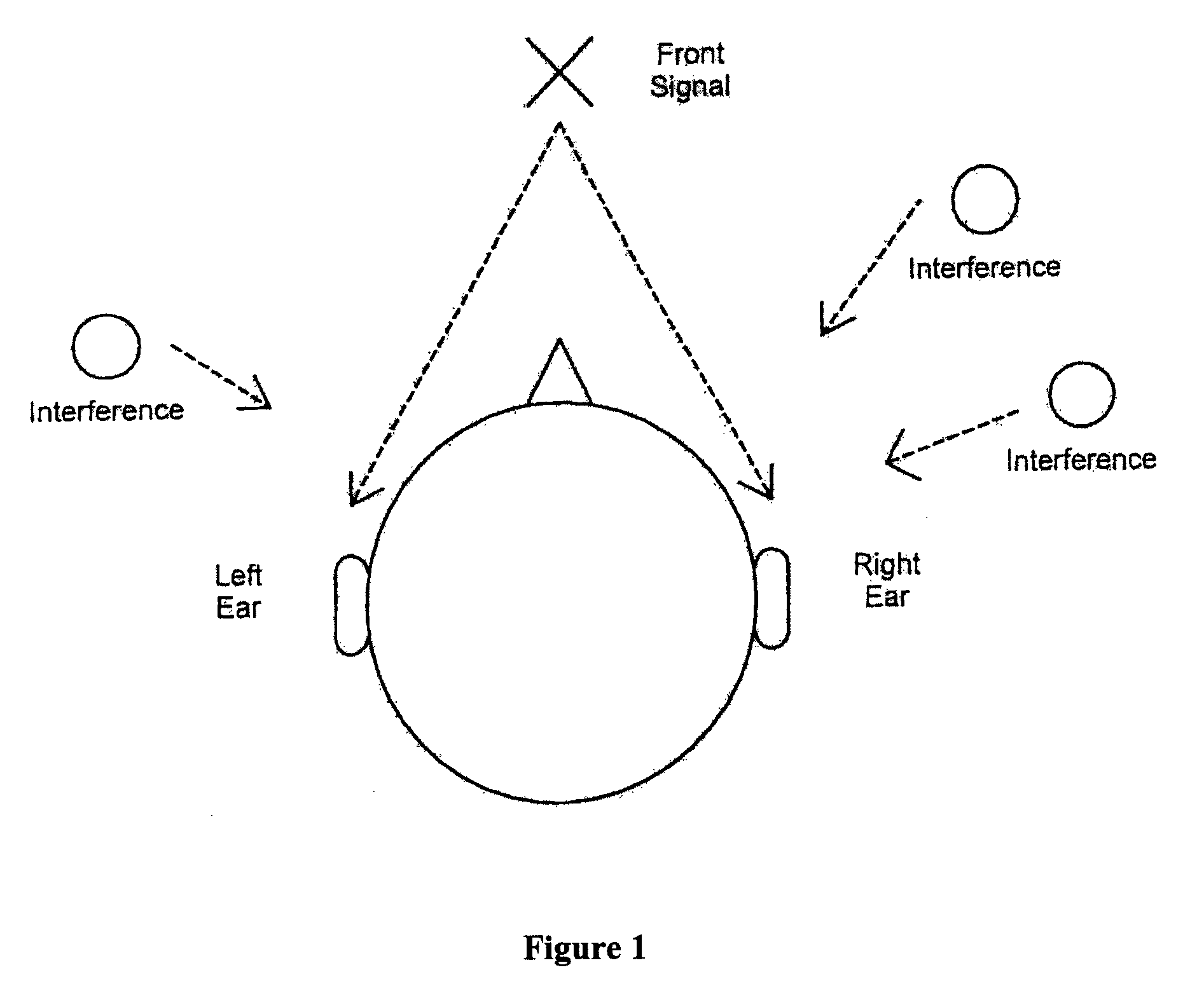 Binaural signal enhancement system