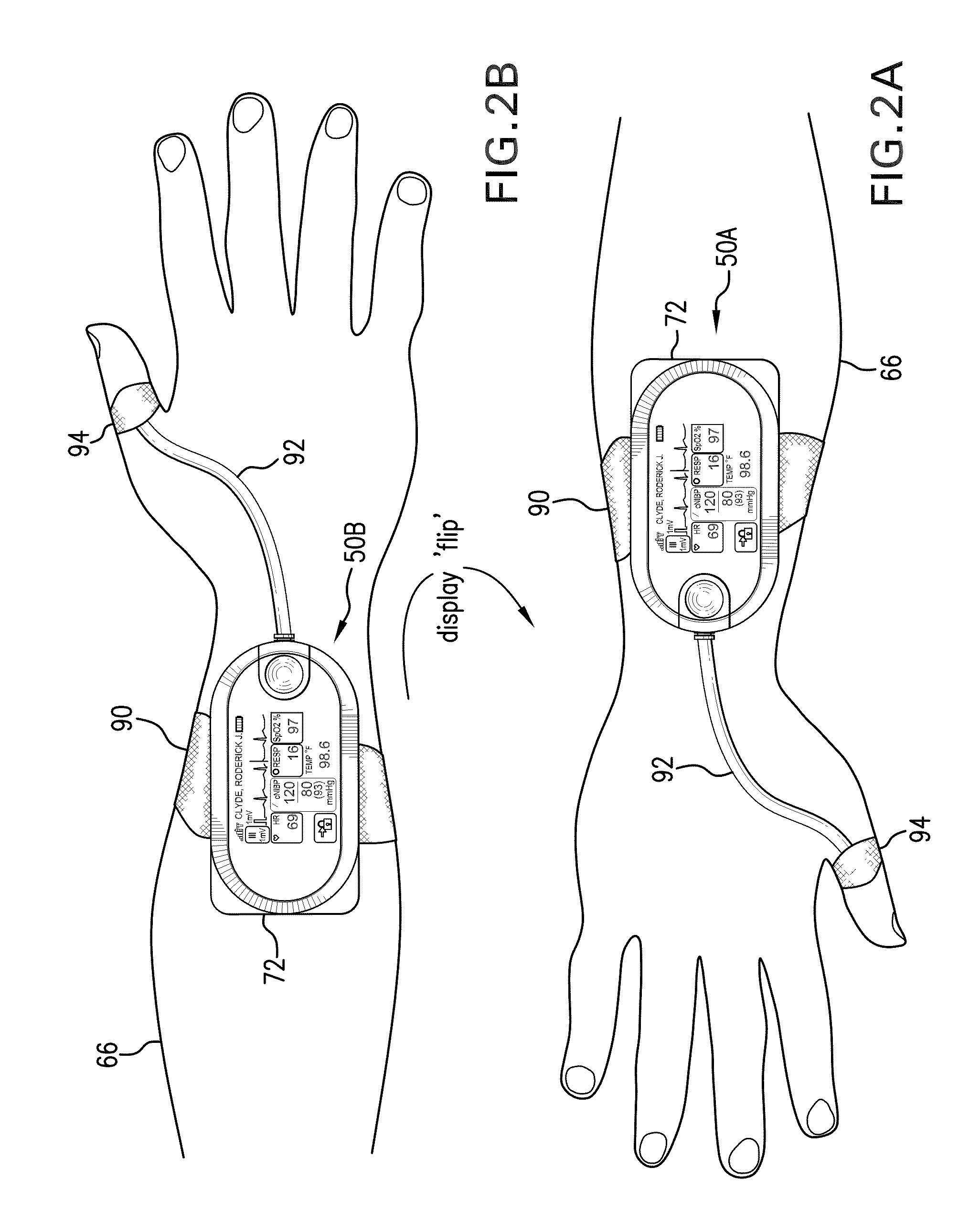 Body-worn vital sign monitor