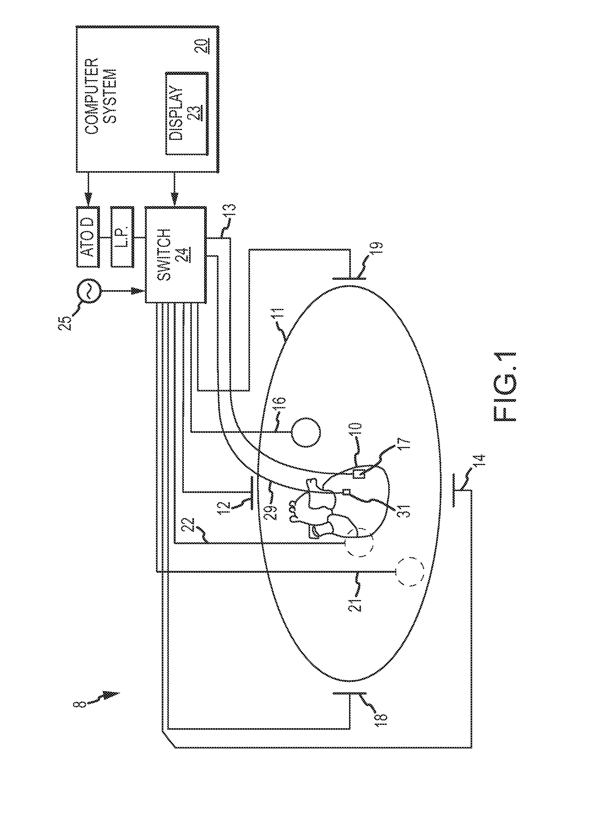 Methods and systems for filtering respiration noise from localization data