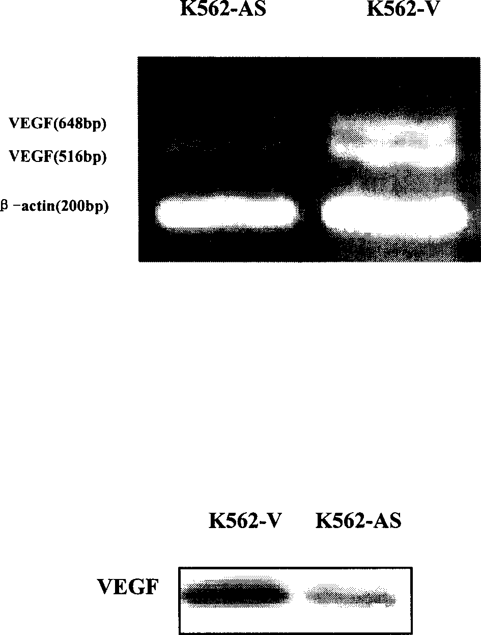 Anti blood tumorous reverse VEGF gene sequence and expression carrier of recombination eukaryon