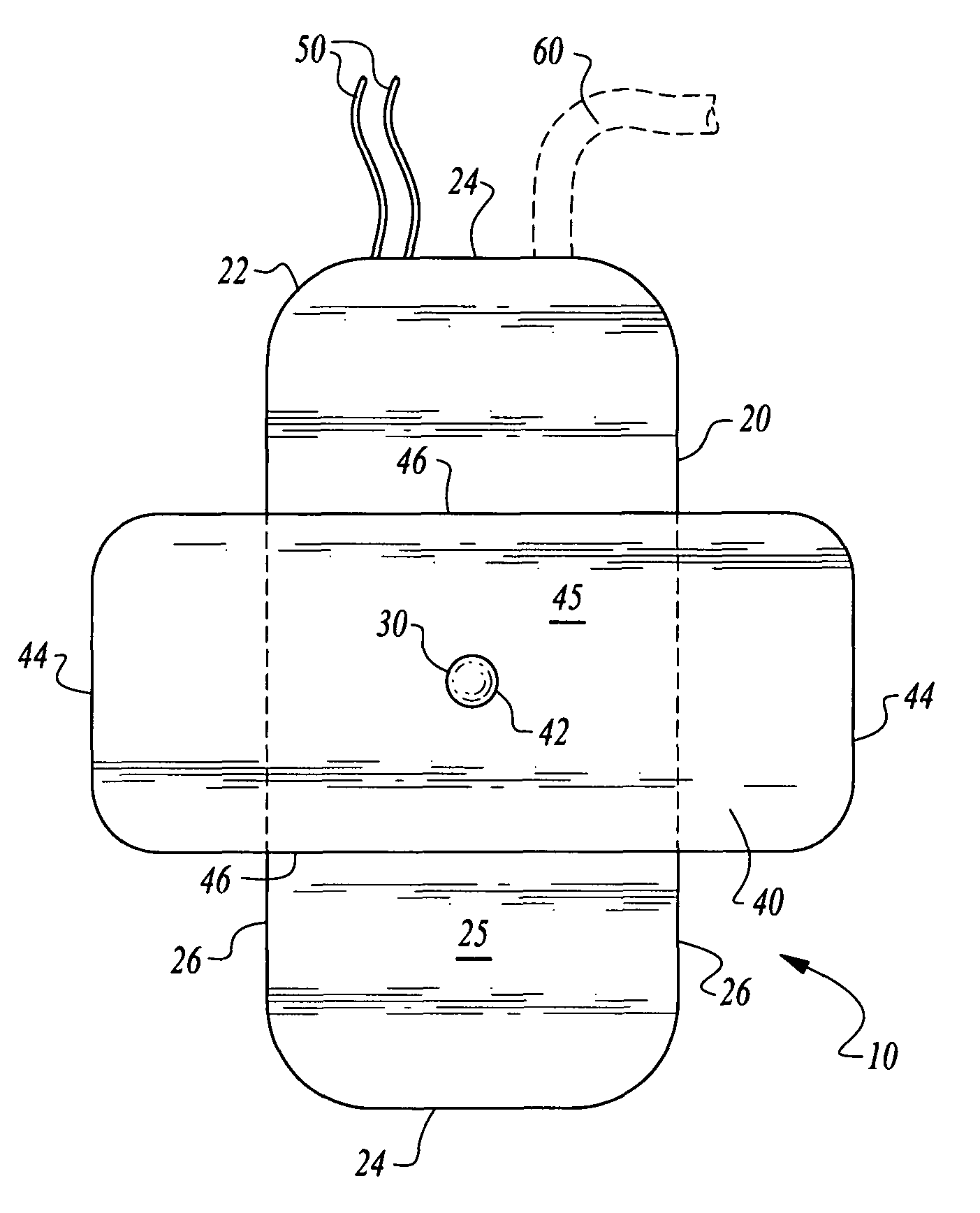 Enhanced stability implantable medical device