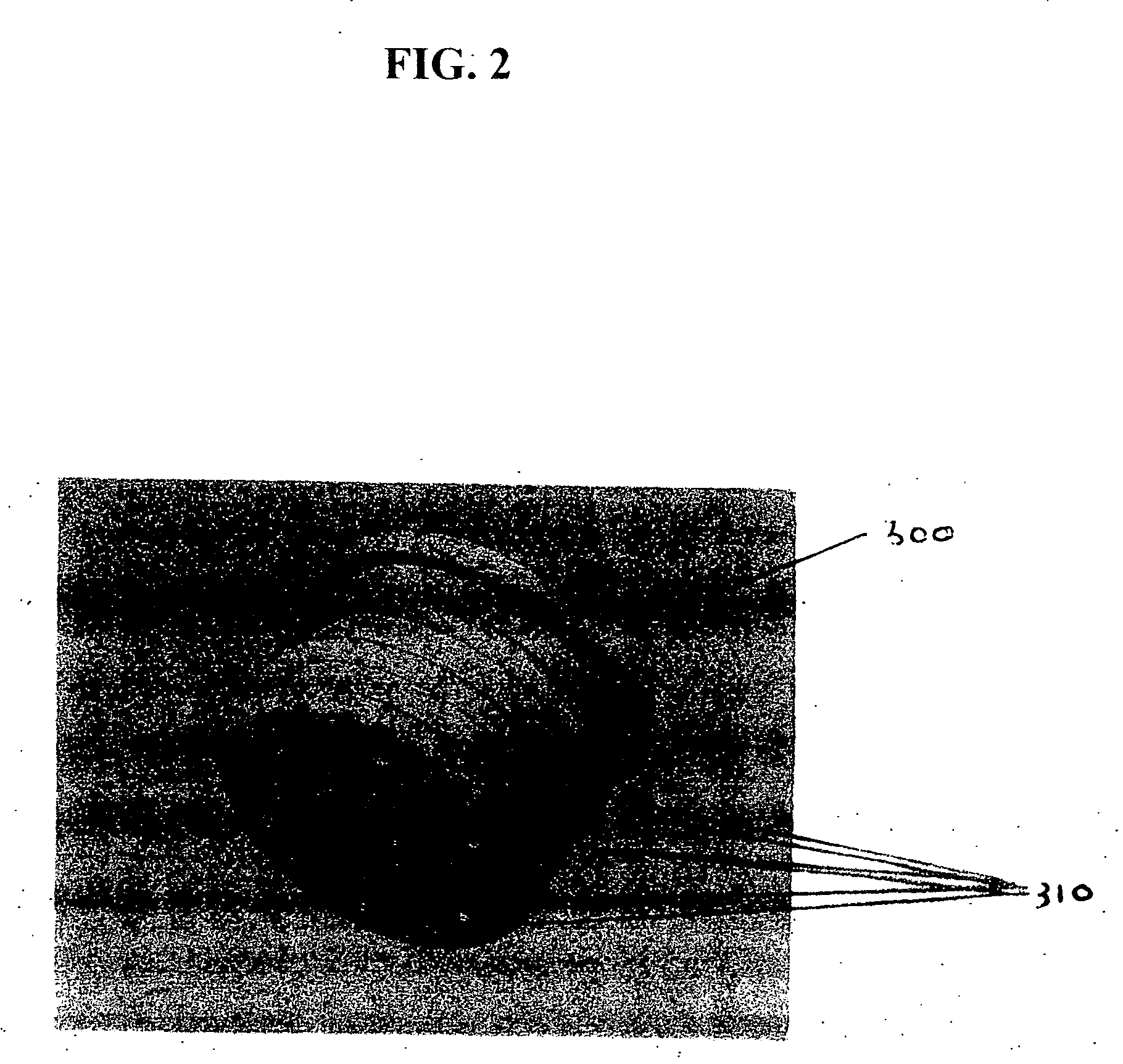 Multi-functional container closure delivery system