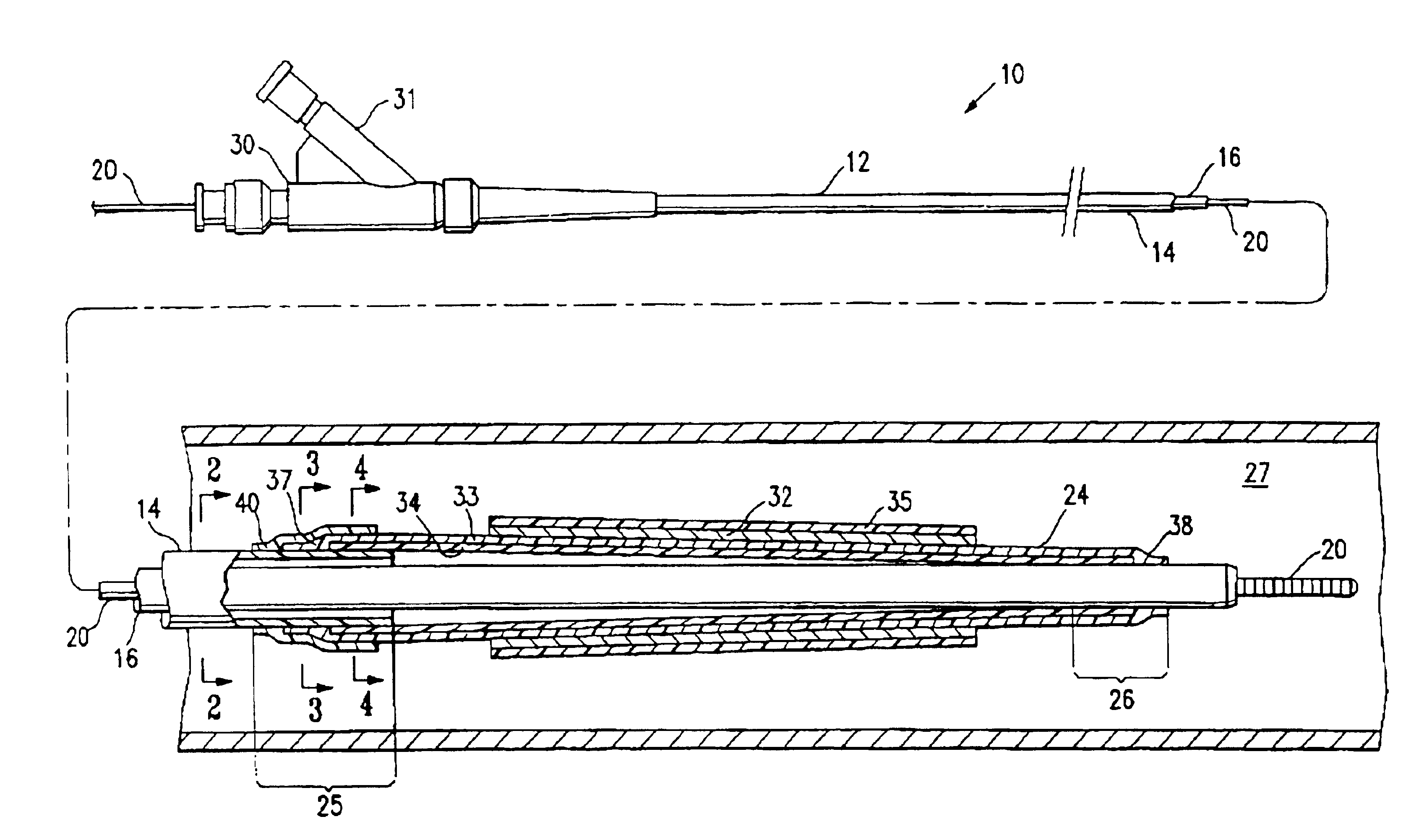 Catheter balloon having improved balloon bonding