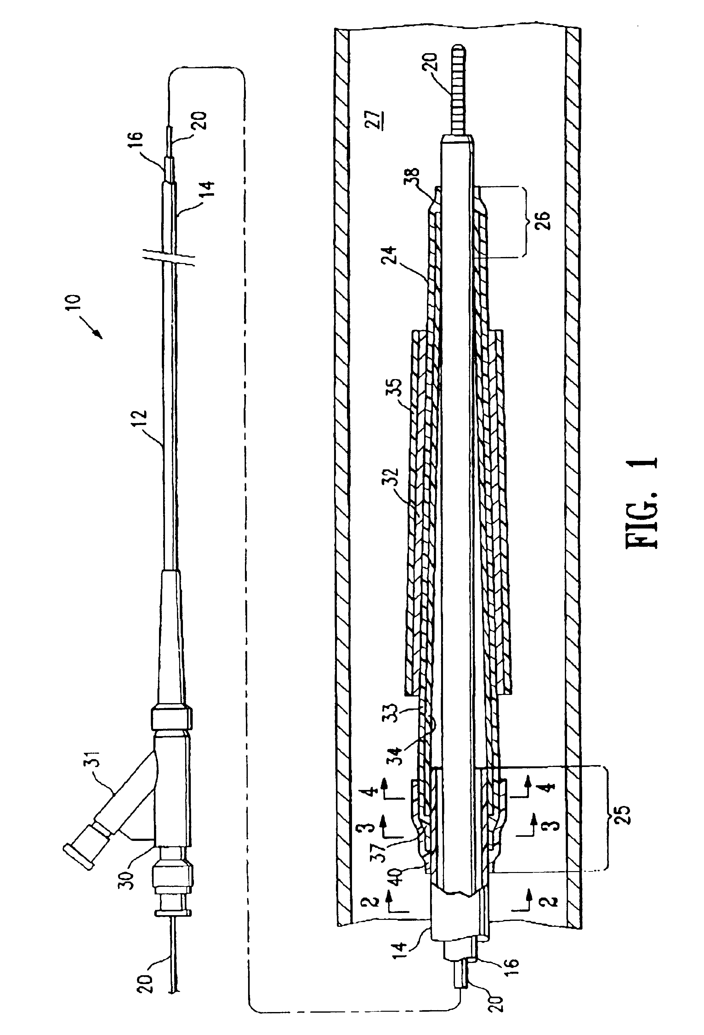 Catheter balloon having improved balloon bonding