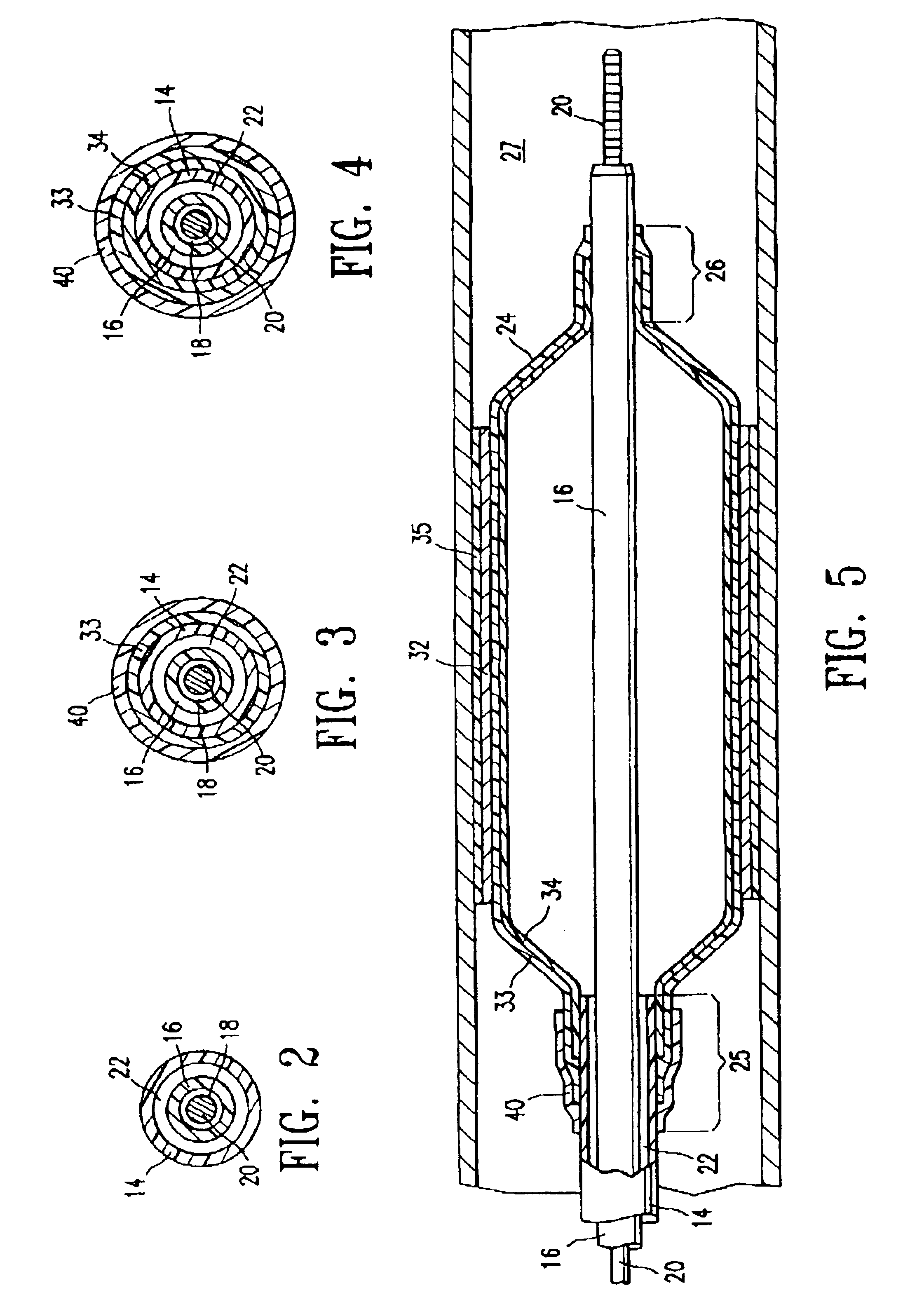 Catheter balloon having improved balloon bonding