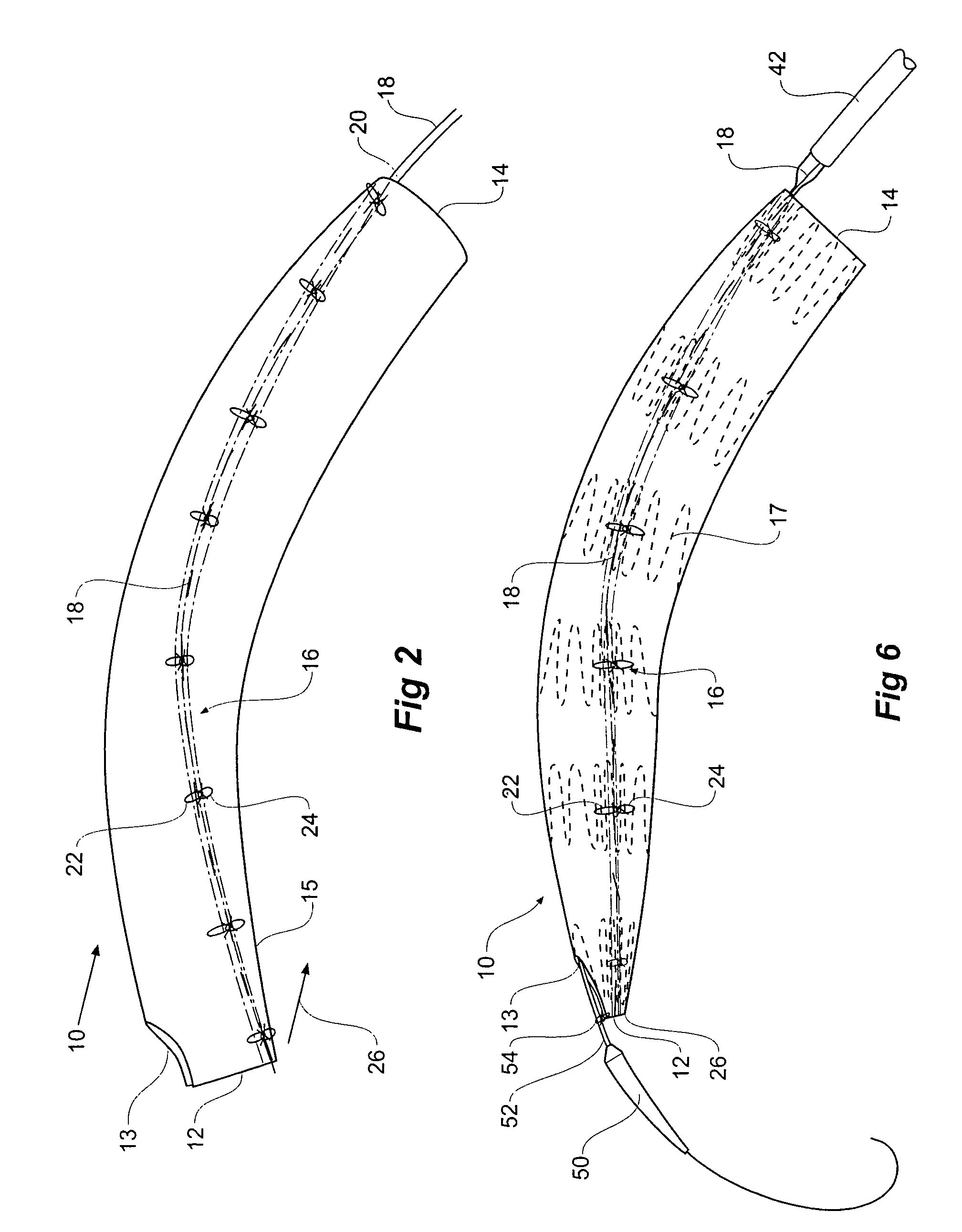 Stent grafts for the thoracic aorta