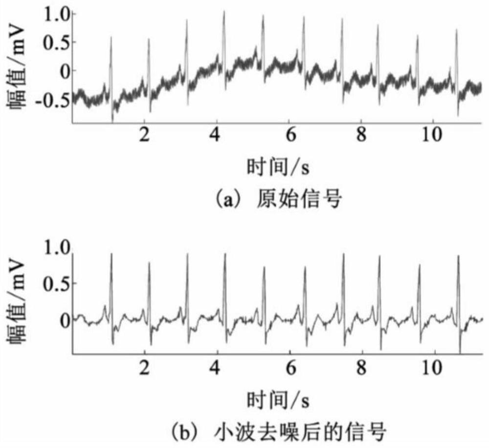 Electrocardiosignal graph classification method based on deep learning