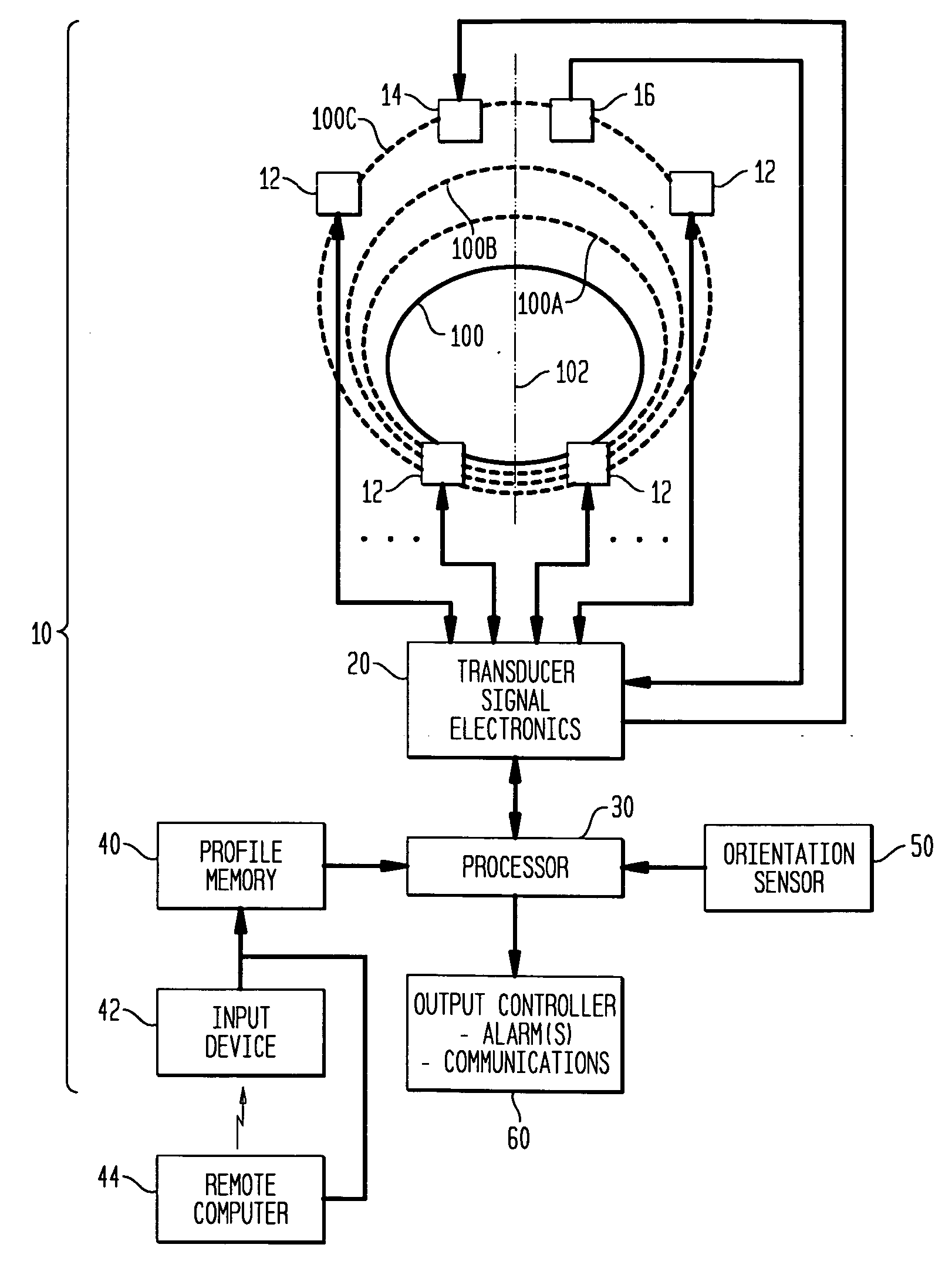 System and method for monitoring bladder distention in a variety of patients having differing anatomical proportions