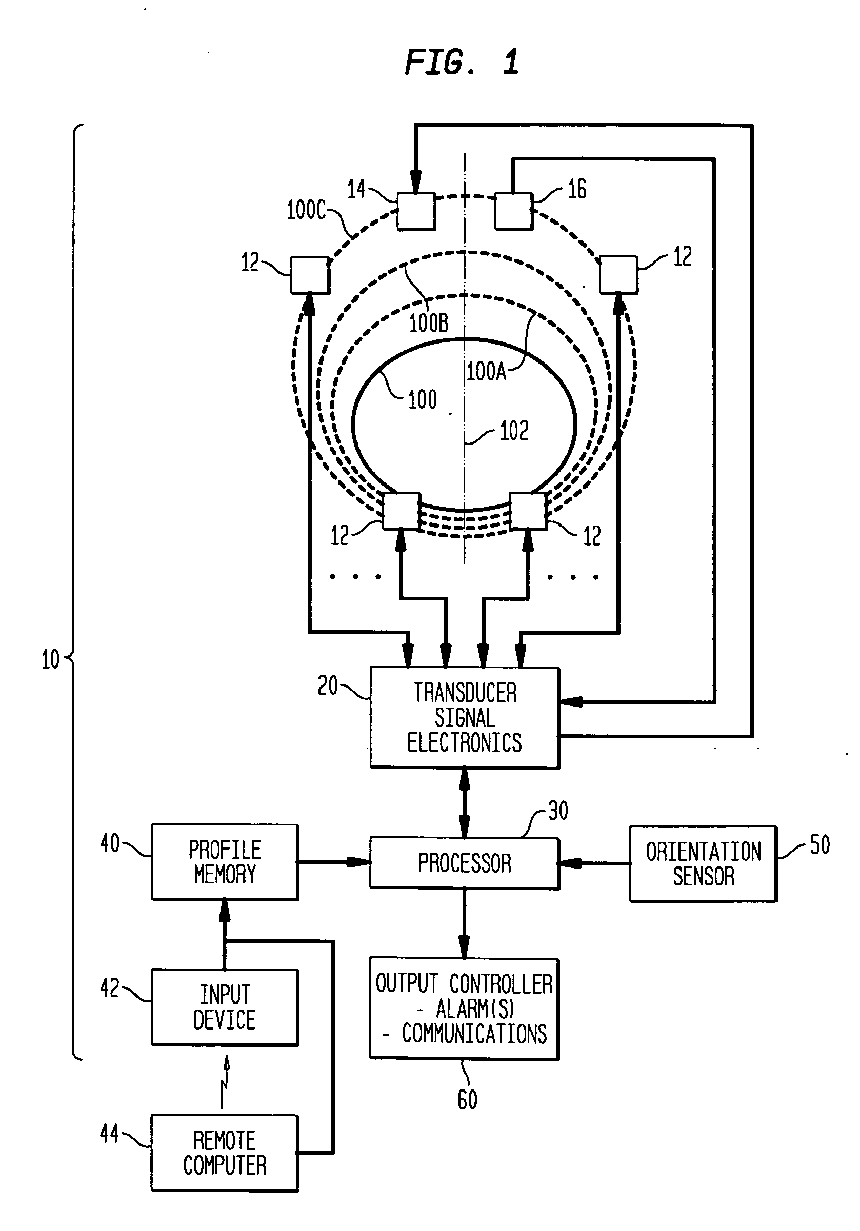 System and method for monitoring bladder distention in a variety of patients having differing anatomical proportions