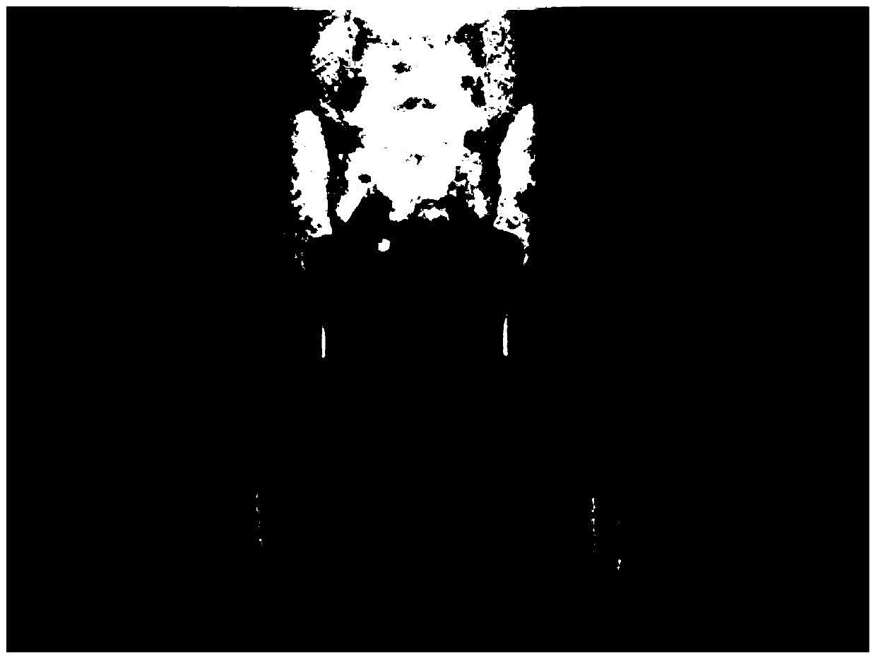 Key point extraction and bone age prediction method in hip joint images