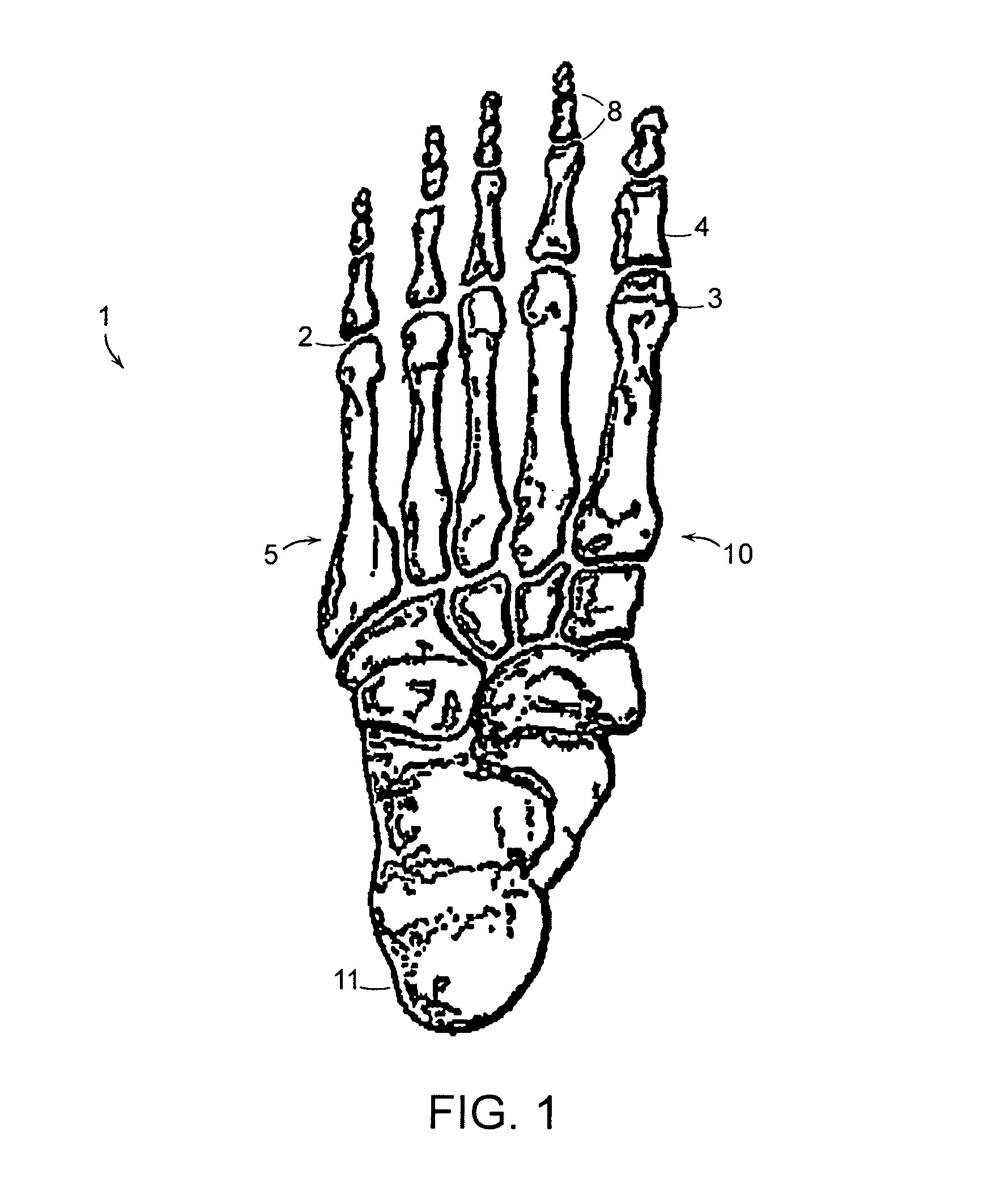 Sole elements of varying density and methods of manufacture