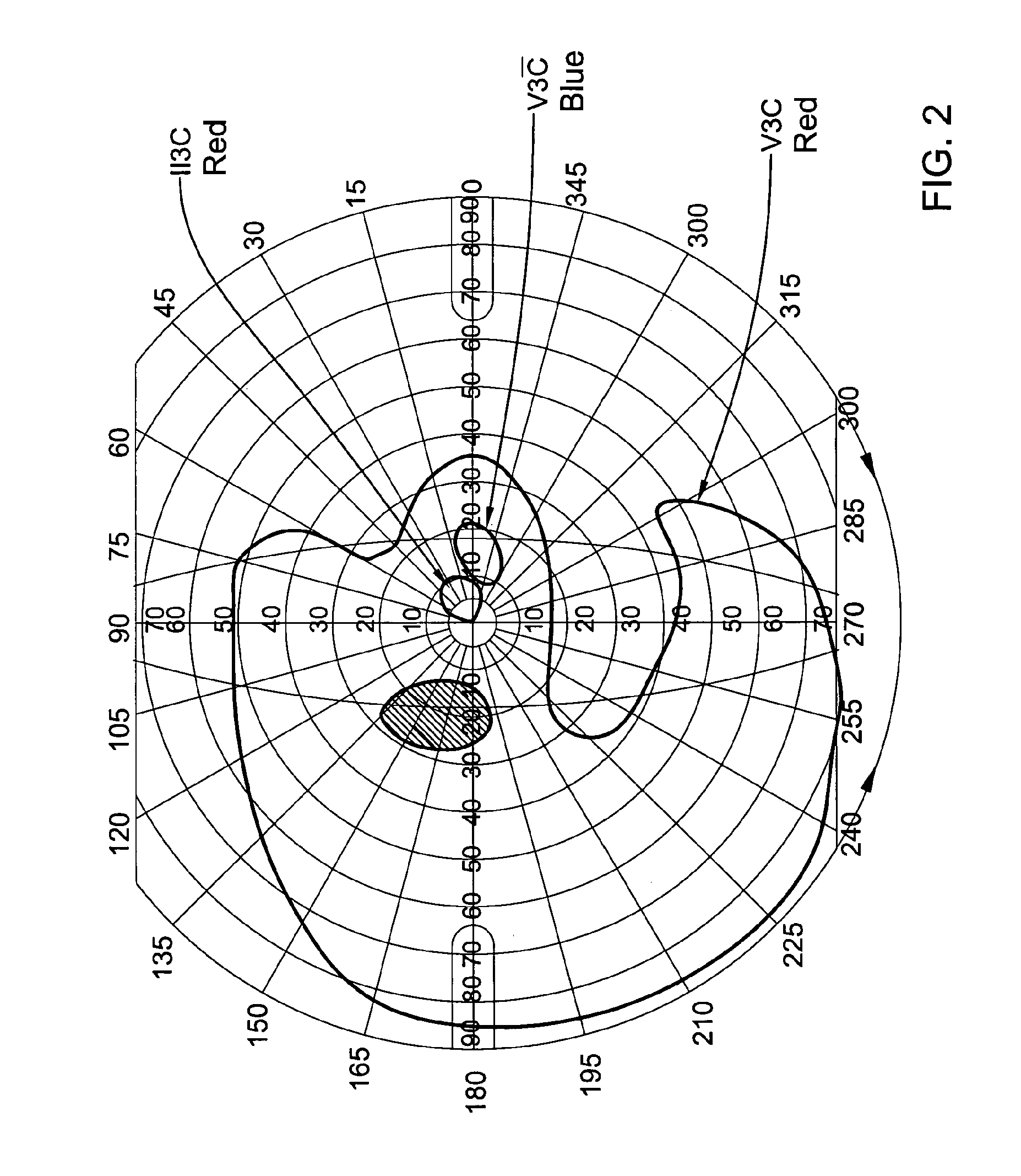 Method of treating retinitis pigmentosa