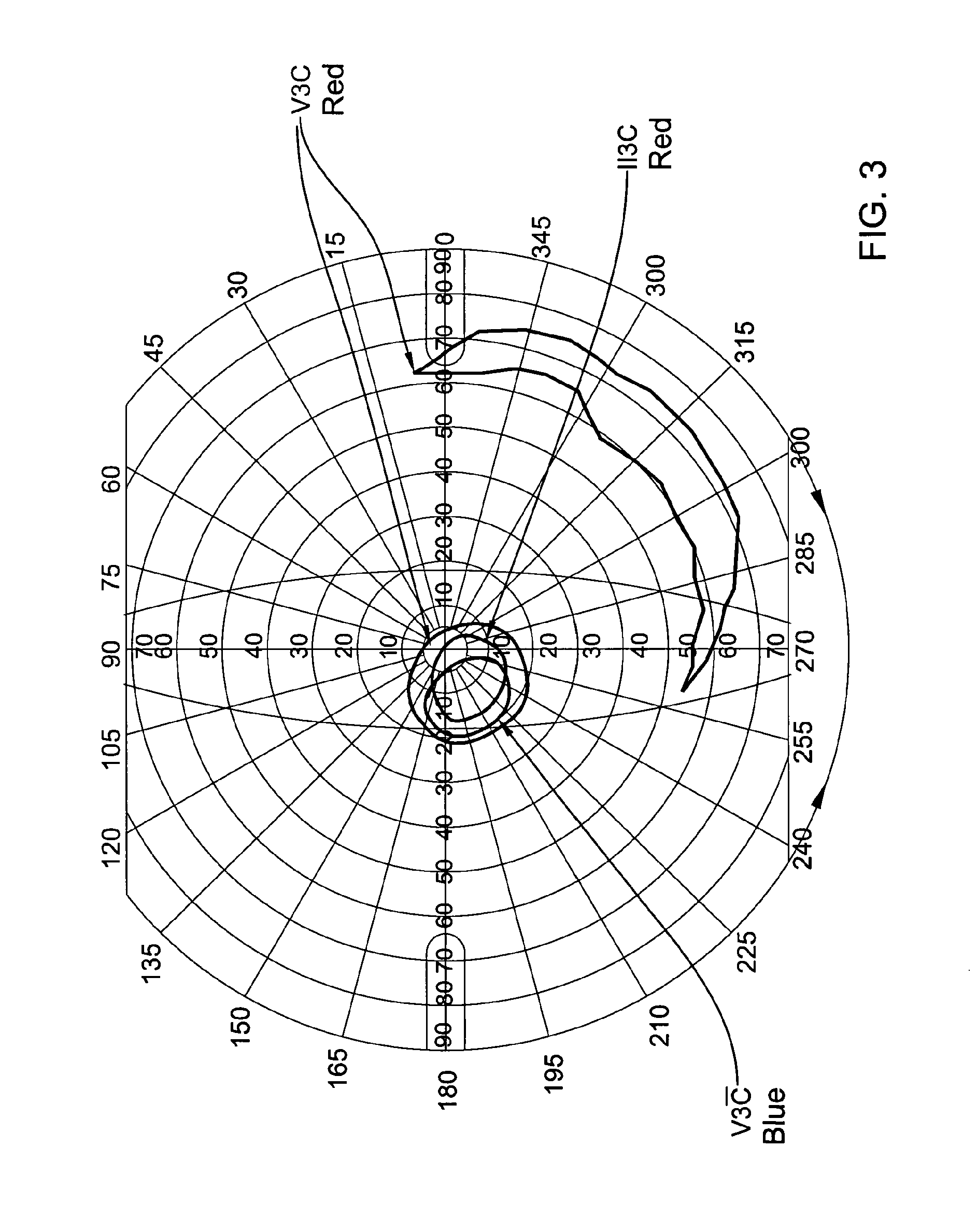 Method of treating retinitis pigmentosa