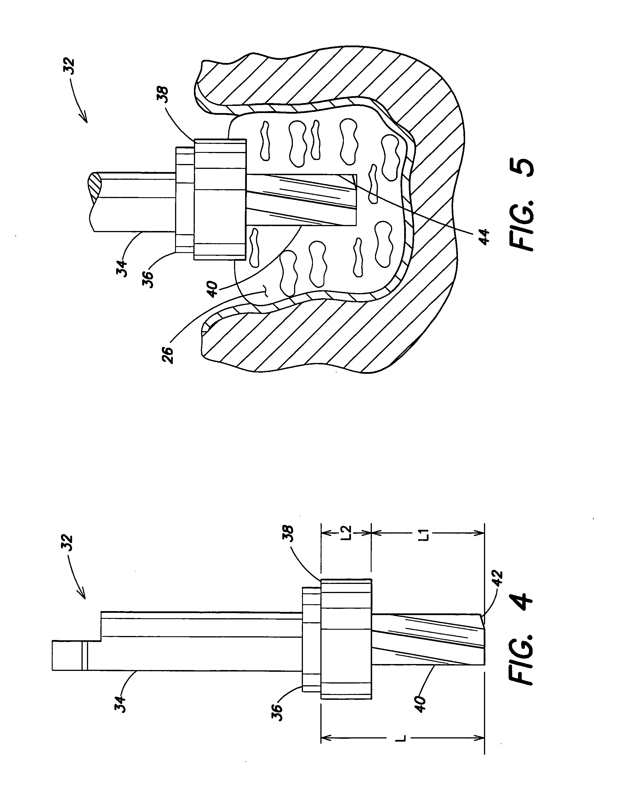 Drilling system and method for dental implants