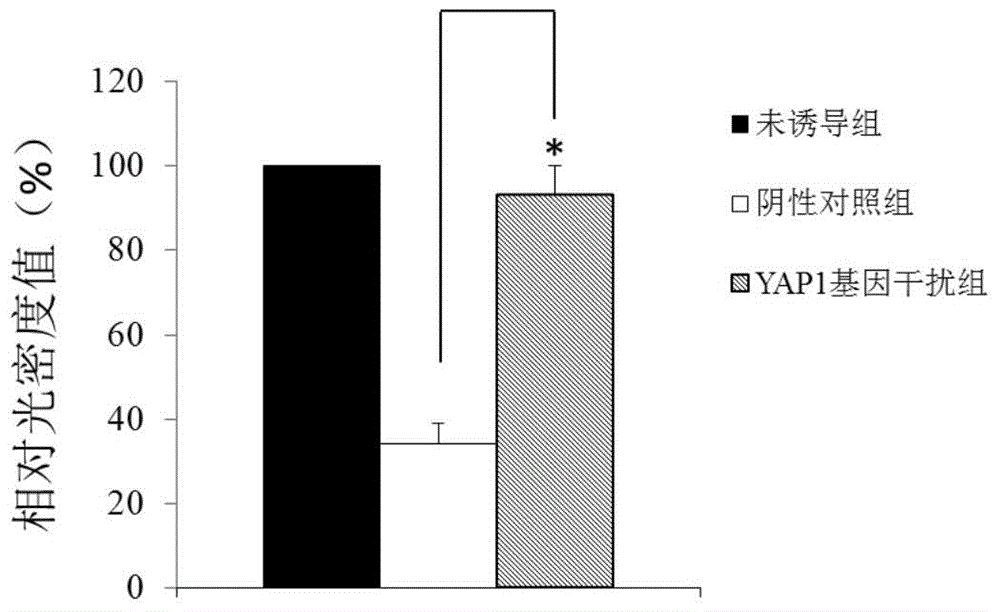 Application of YAP1 gene in diagnosing and treating Alzheimer's disease