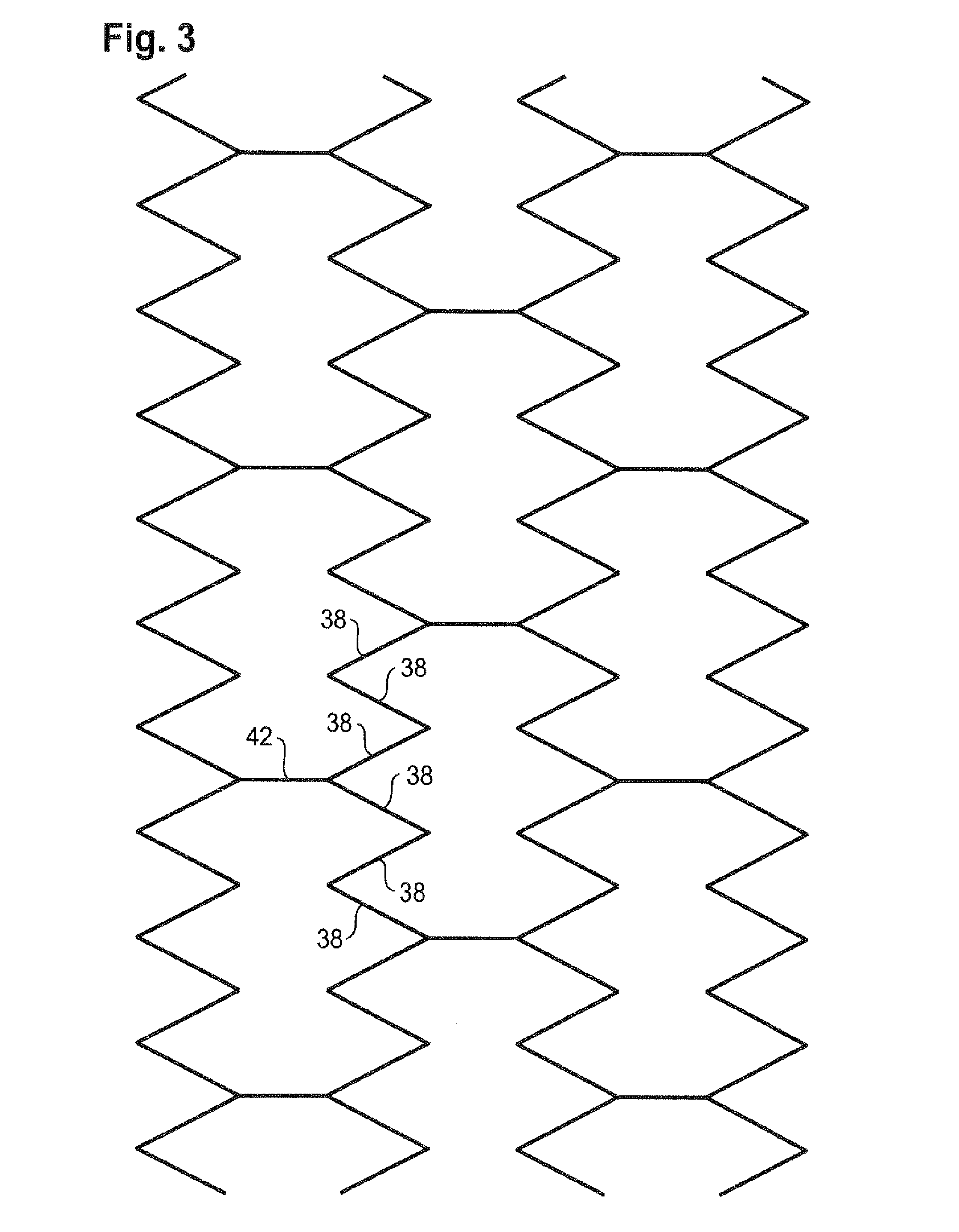 Bend-Capable Stent Prosthesis