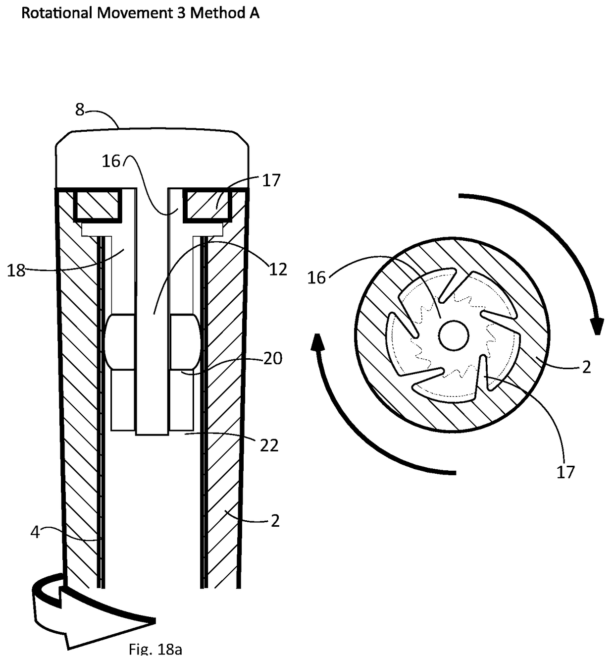 Removable and reattachable golf club grip