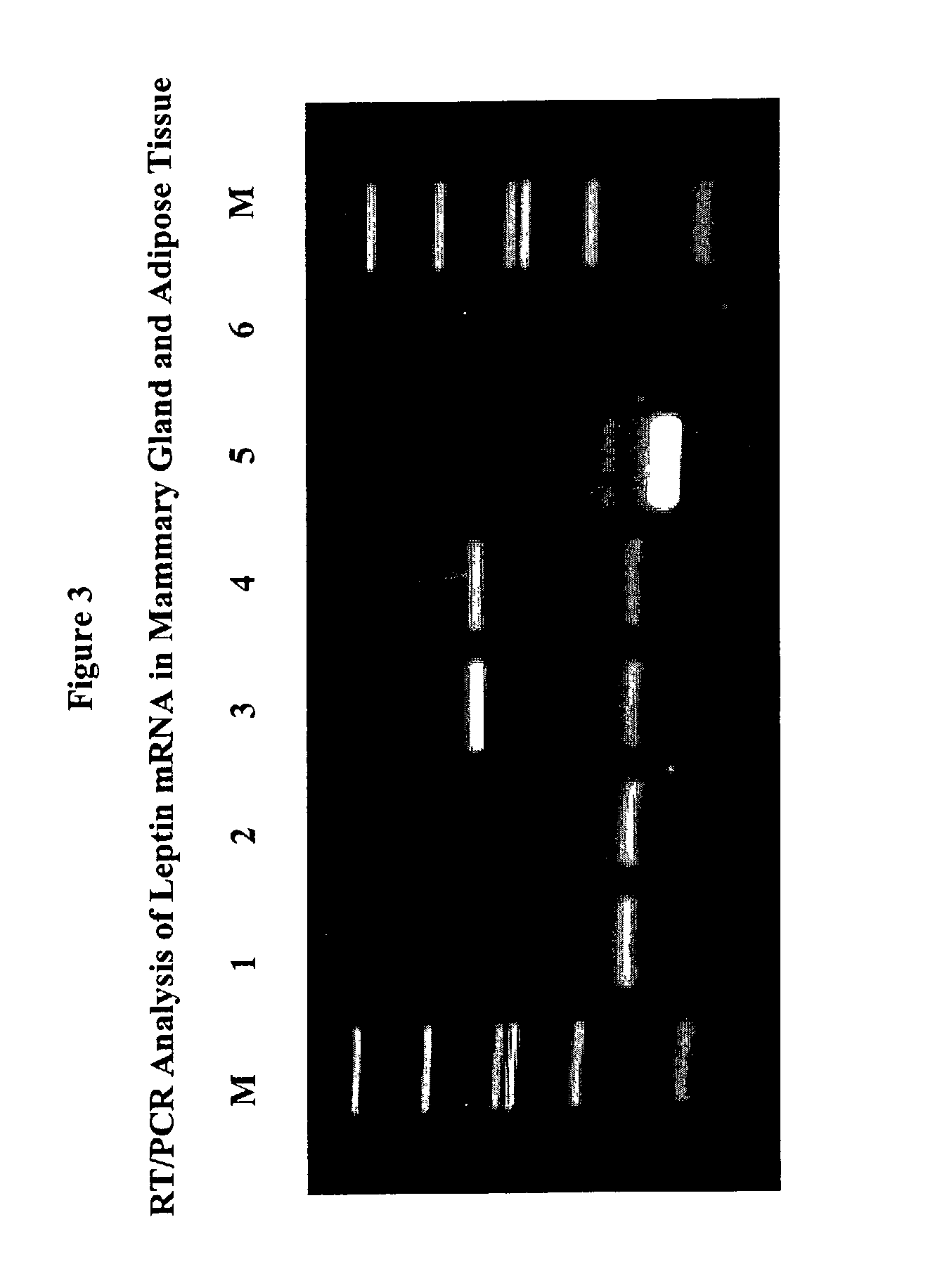 Administration of leptin