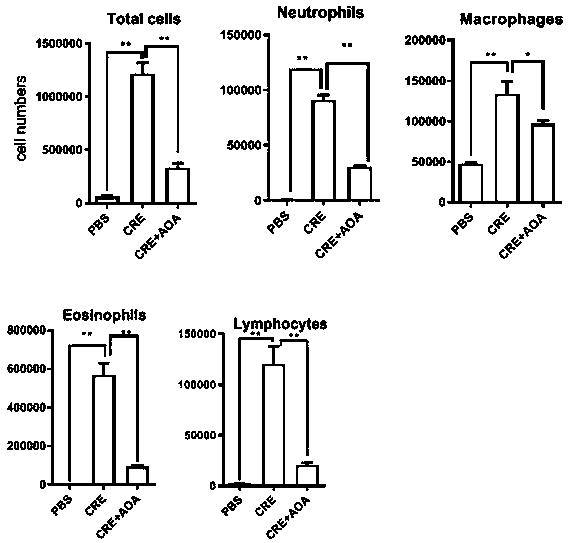 Use of small molecule compound aminoxyacetic acid in preparing medicine for treating asthma