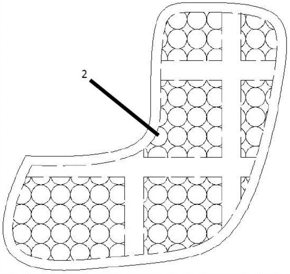 A kind of manufacturing method of personalized customized tantalum implant