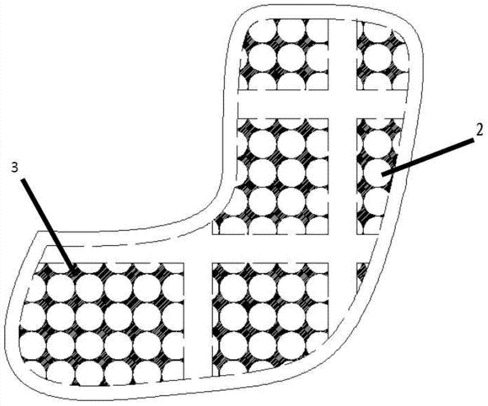 A kind of manufacturing method of personalized customized tantalum implant