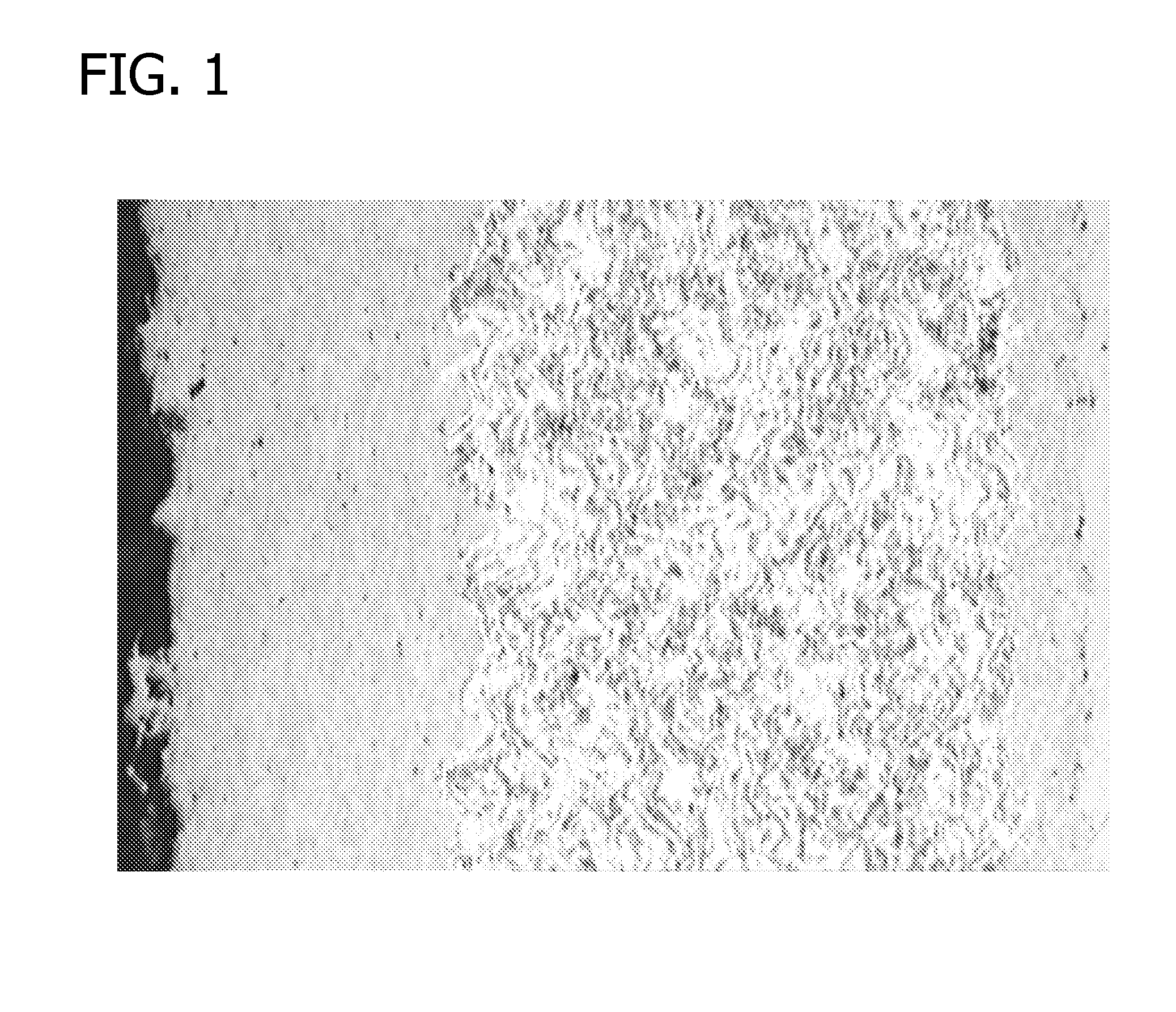 Spallation-resistant multilayer thermal spray metal coatings