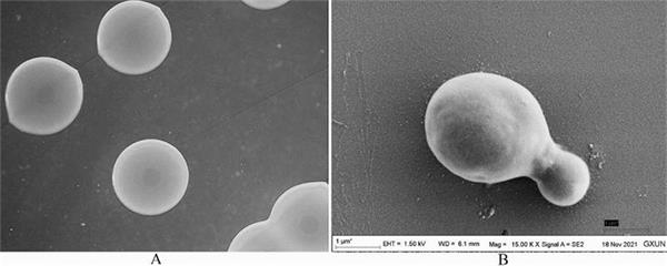 Strain as well as microecological preparation and application thereof