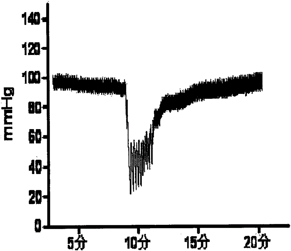 Extraction and separation method of ginkgo active components and application of extracted active substances in drugs for treating cardiovascular and cerebrovascular diseases