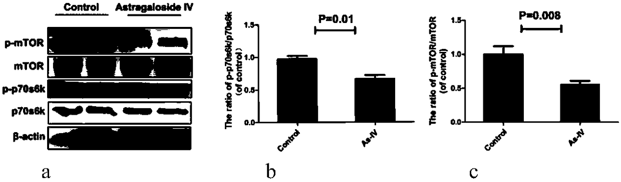 Application of astragaloside IV in preparation of drugs for treating and delaying intervertebral disc degeneration