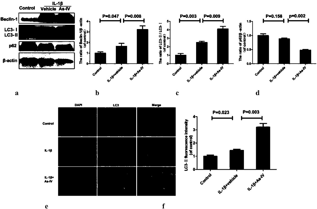 Application of astragaloside IV in preparation of drugs for treating and delaying intervertebral disc degeneration