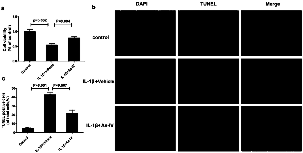 Application of astragaloside IV in preparation of drugs for treating and delaying intervertebral disc degeneration