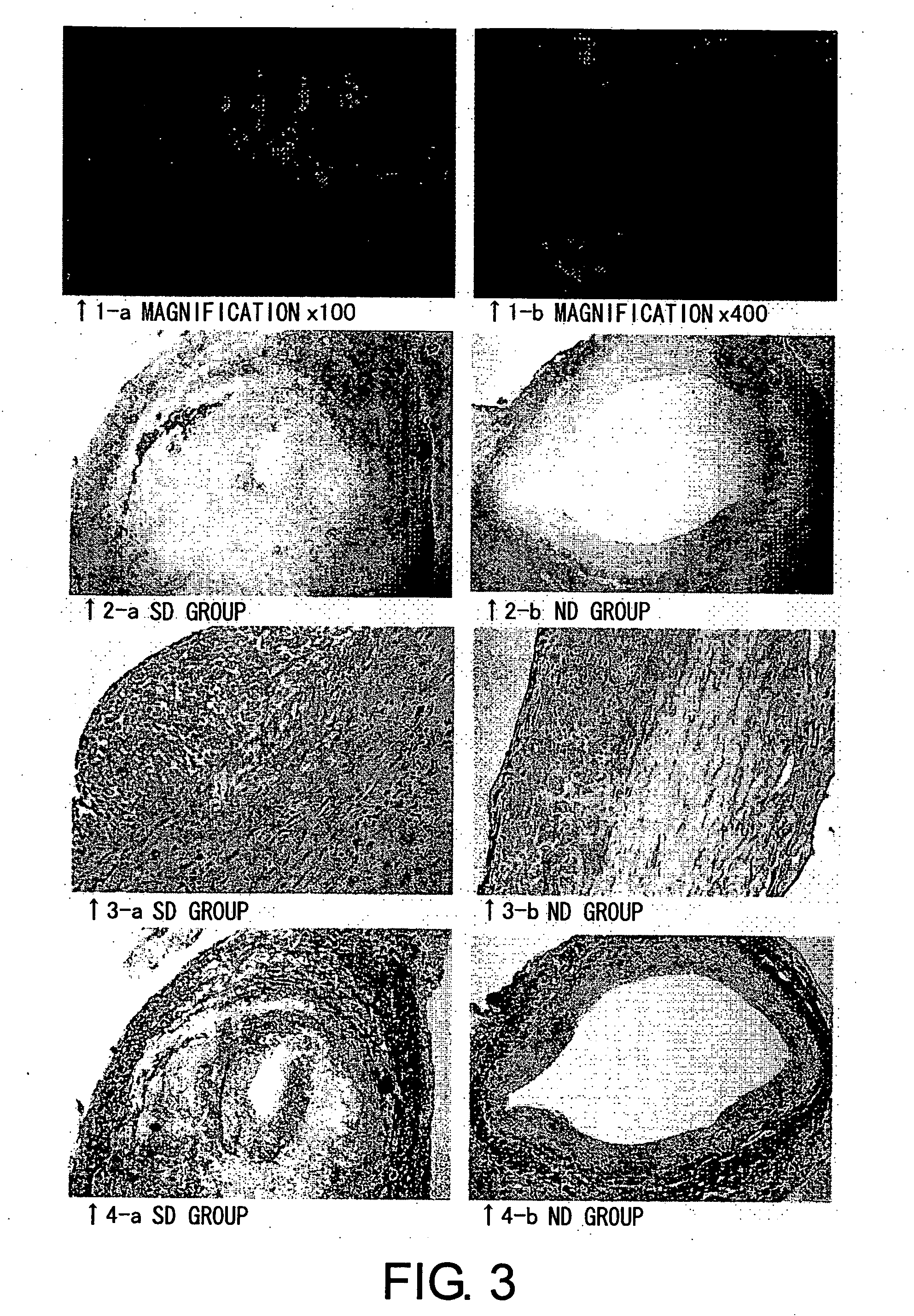 Agents for protection from neointimal formation in grafts comprising an nfkappab decoy