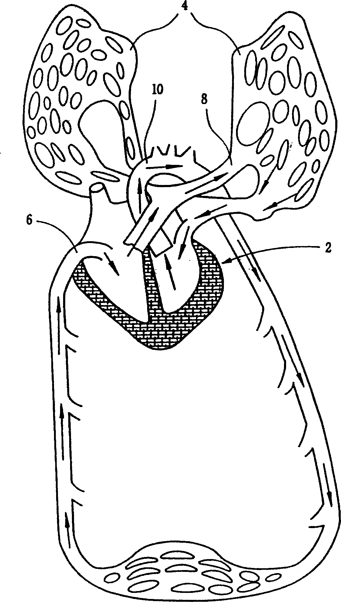 External heart-lung life-supporting system with two beating pump