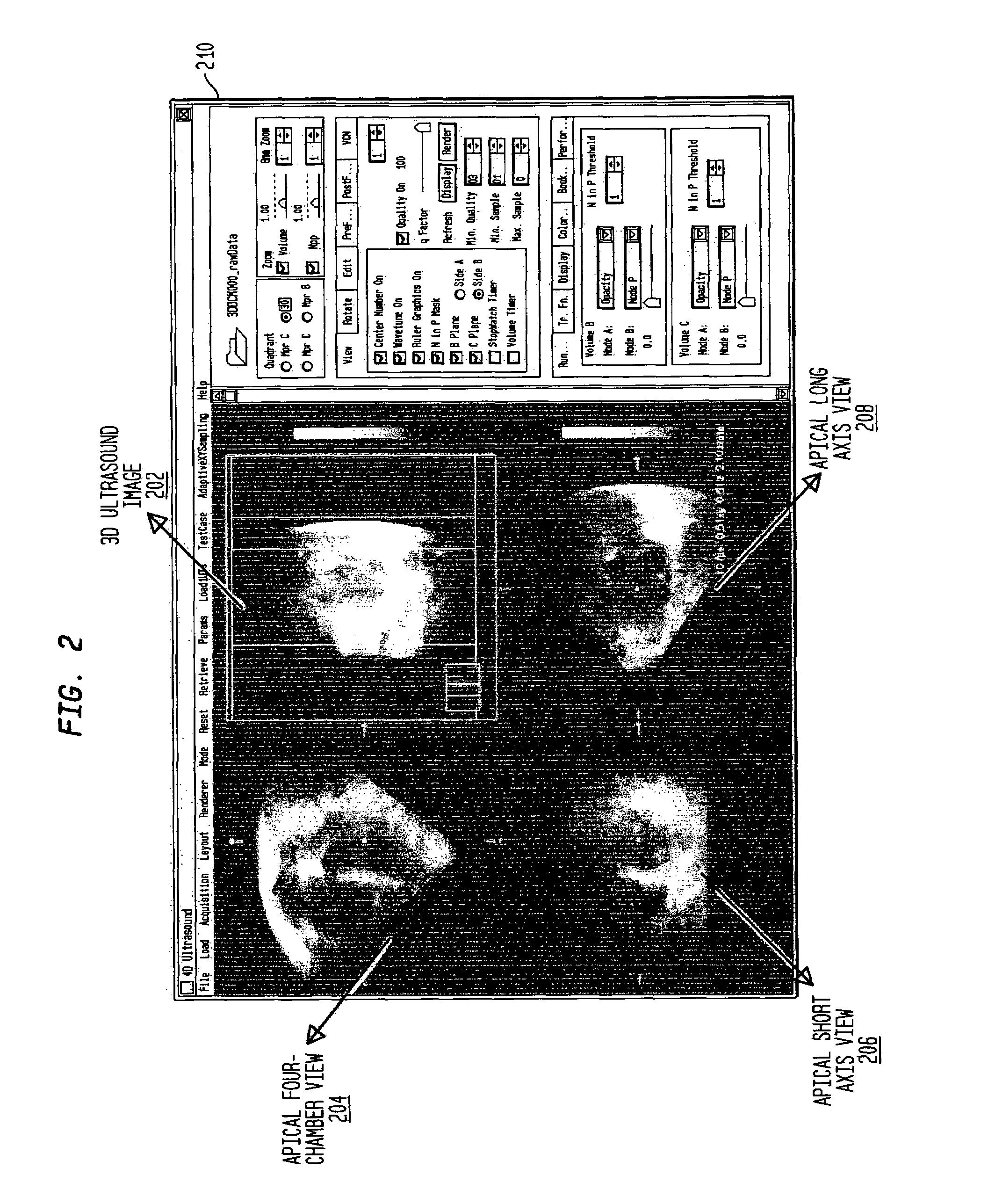 System and method for tracking anatomical structures in three dimensional images