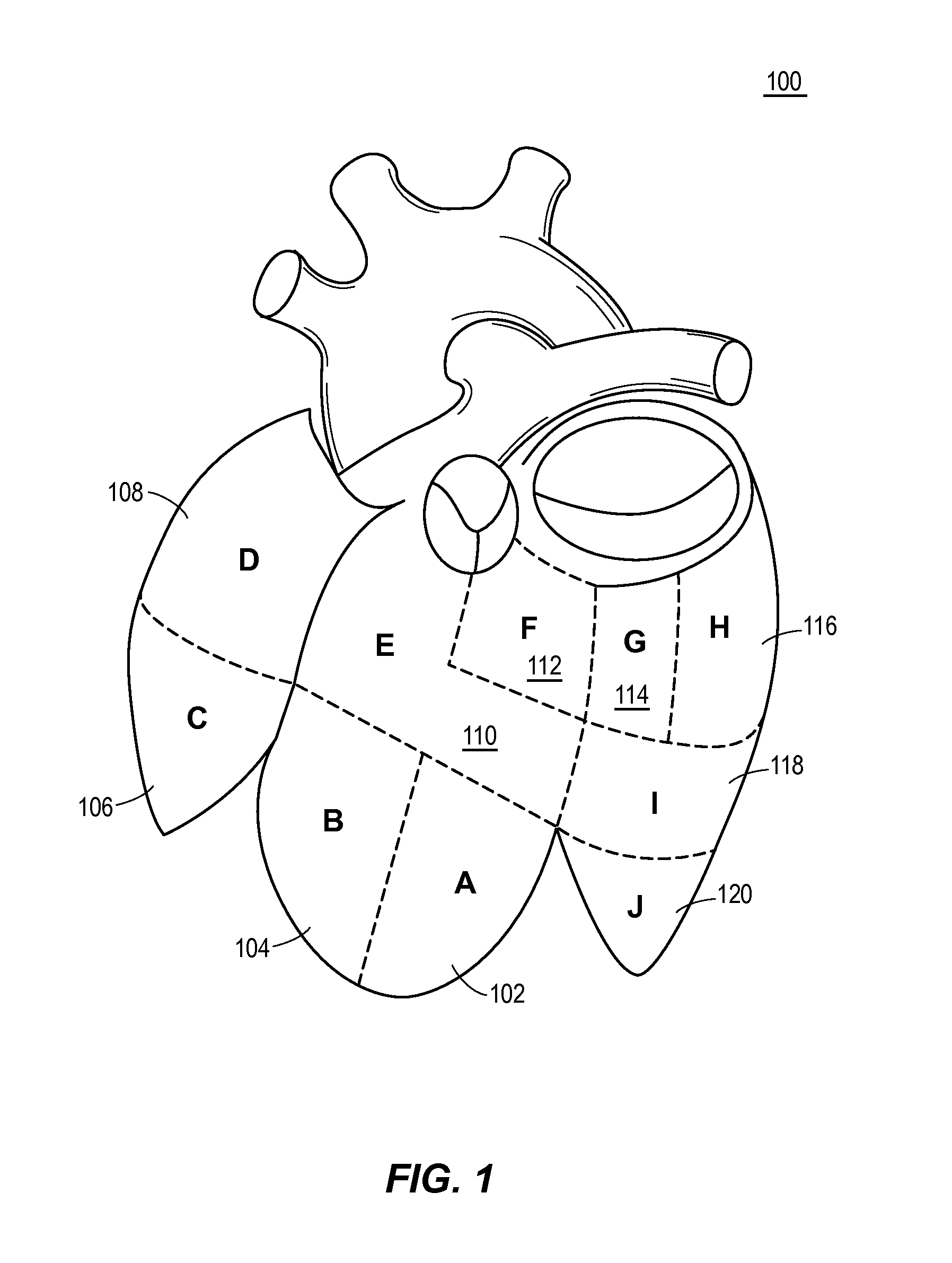 Automated analysis of multi-lead electrocardiogram data to identify the exit sites of physiological conditions