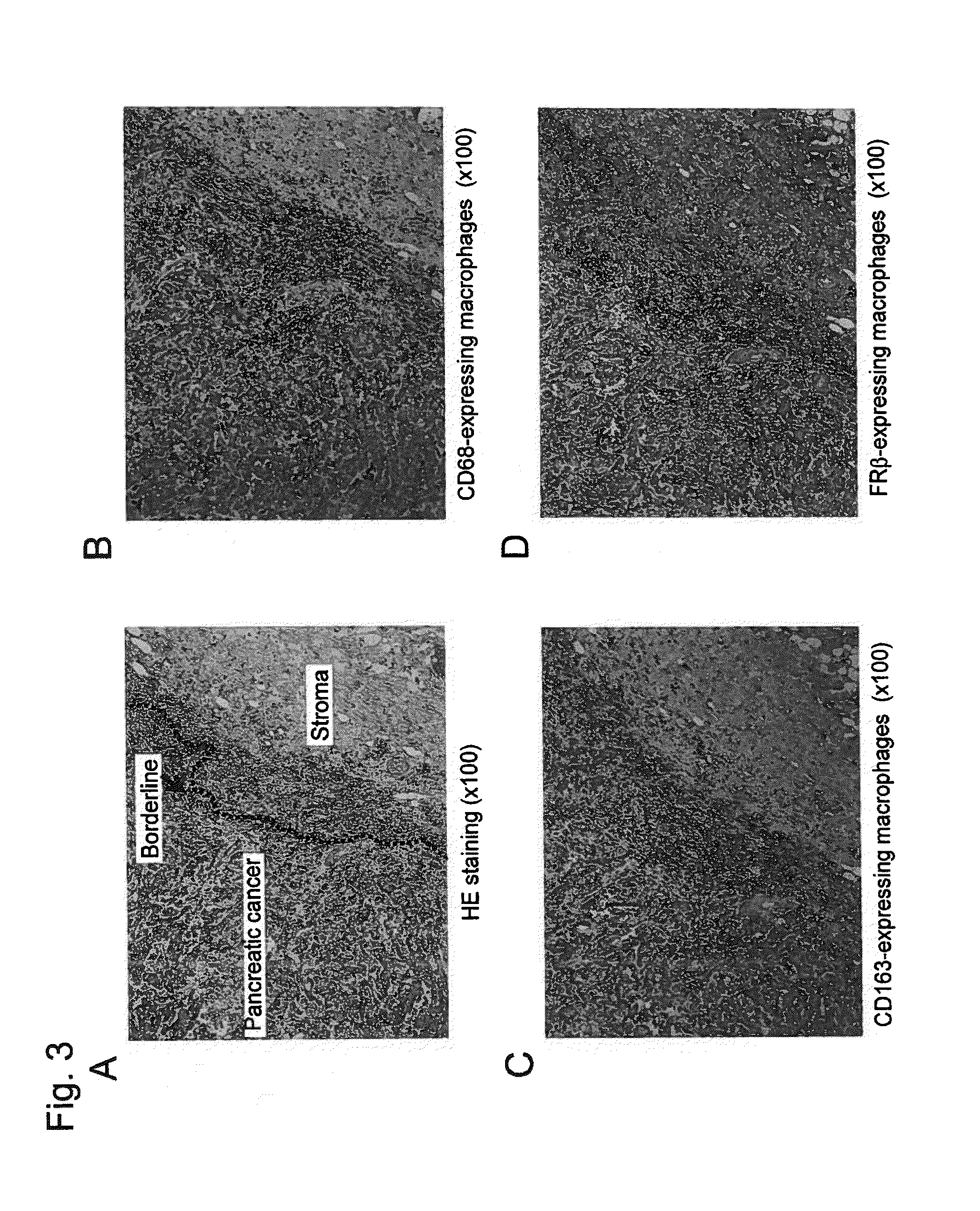 Composition for treatment and diagnosis of pancreatic cancer