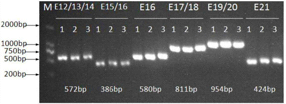 Kit and method for detecting STAT3 gene mutation of high IgE (Immunoglobulin E) syndrome