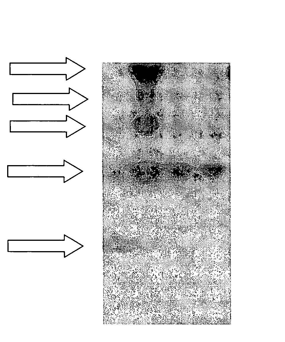 Variant Amyloid Protein