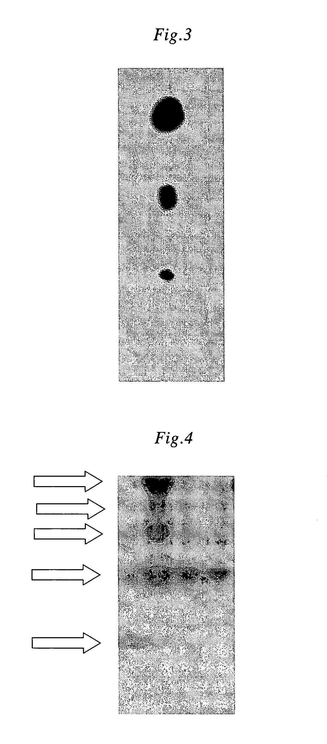 Variant Amyloid Protein