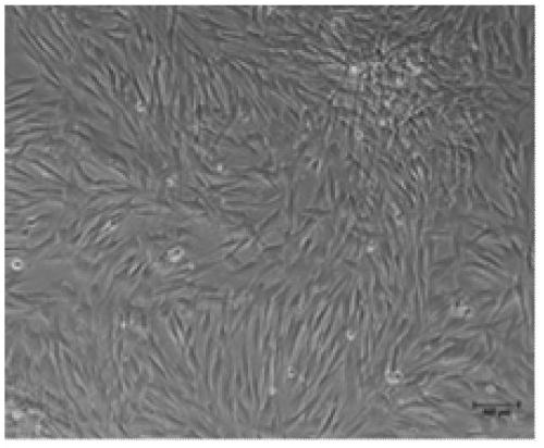 Chinese soft-shelled turtle heart cell continuous cell line and its construction method and ultra-low temperature cryopreservation method