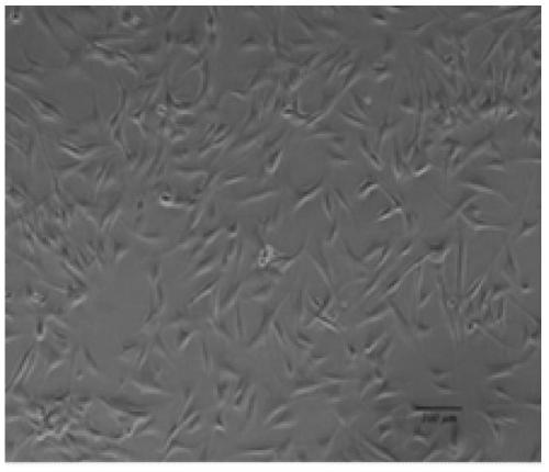 Chinese soft-shelled turtle heart cell continuous cell line and its construction method and ultra-low temperature cryopreservation method