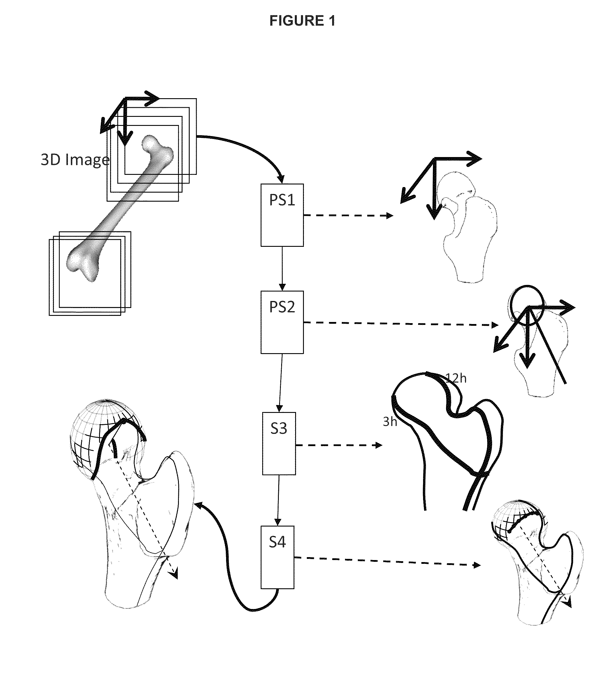 Method and system of automatic determination of geometric elements characterizing a bone deformation from 3D image