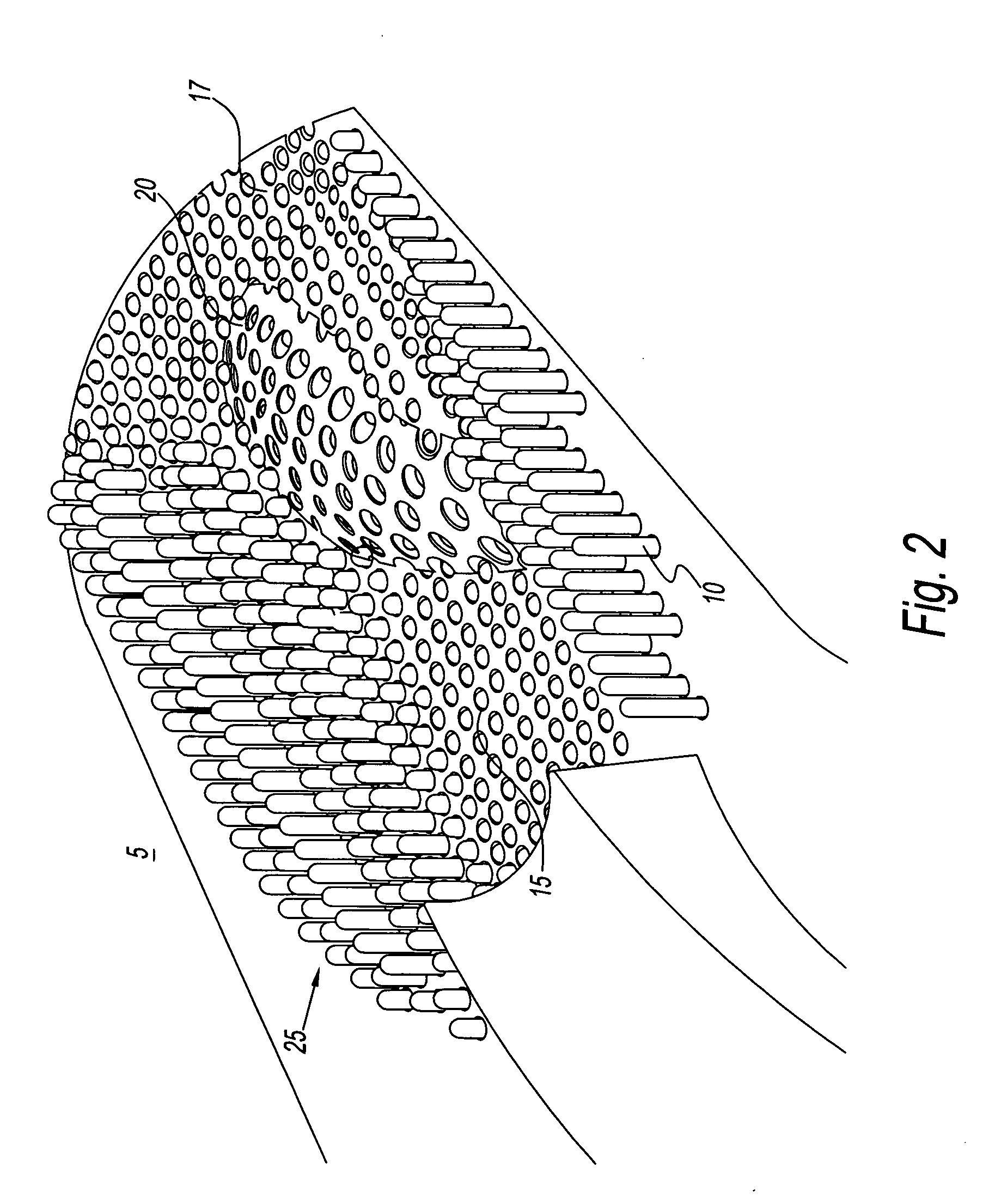 Method and system for capturing and supporting 3-D contour