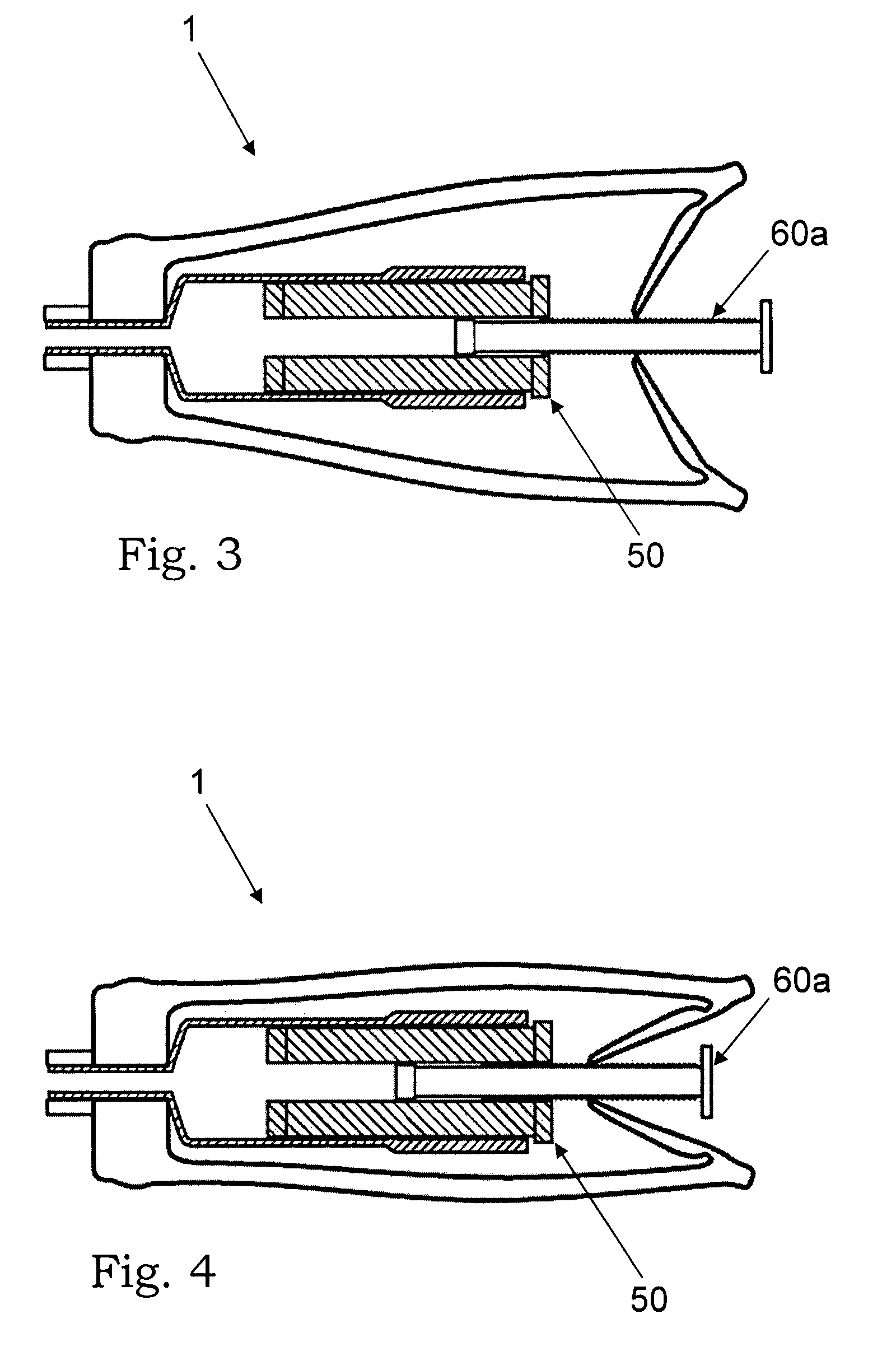 Mixing and injection system for injectable biomaterials or artificial materials in orthopaedic applications