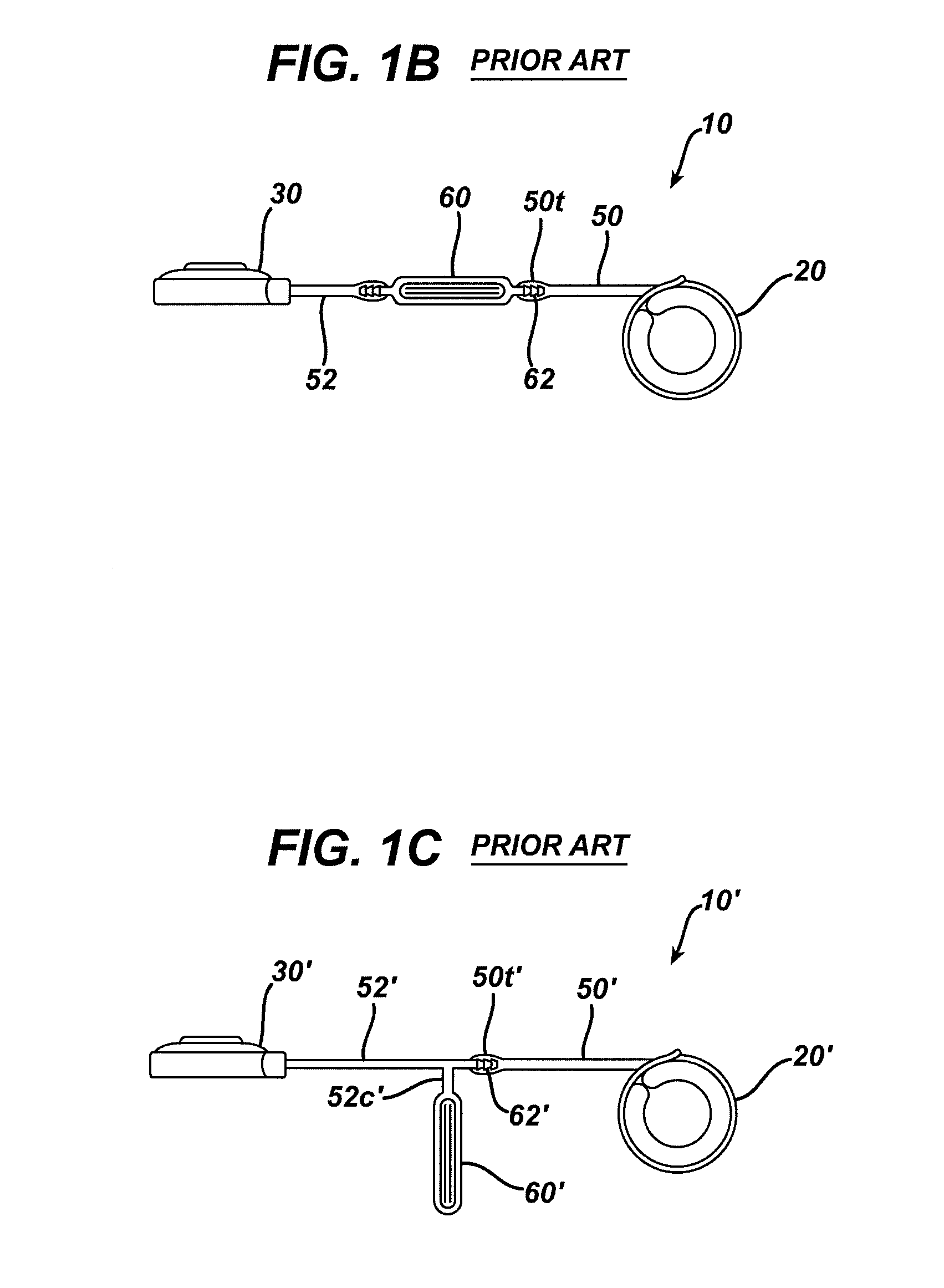 Methods for implanting a gastric restriction device