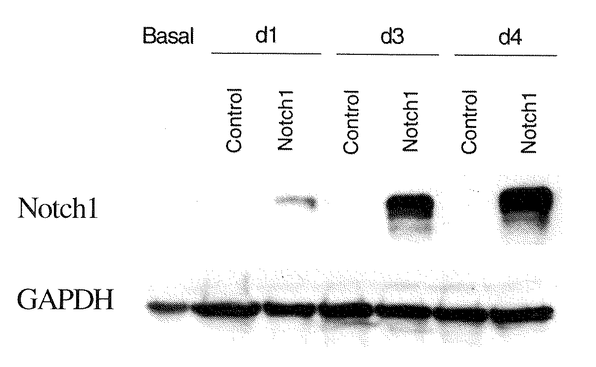 Modulating Notch1 Signaling Pathway for Treating Neuroendocrine Tumors