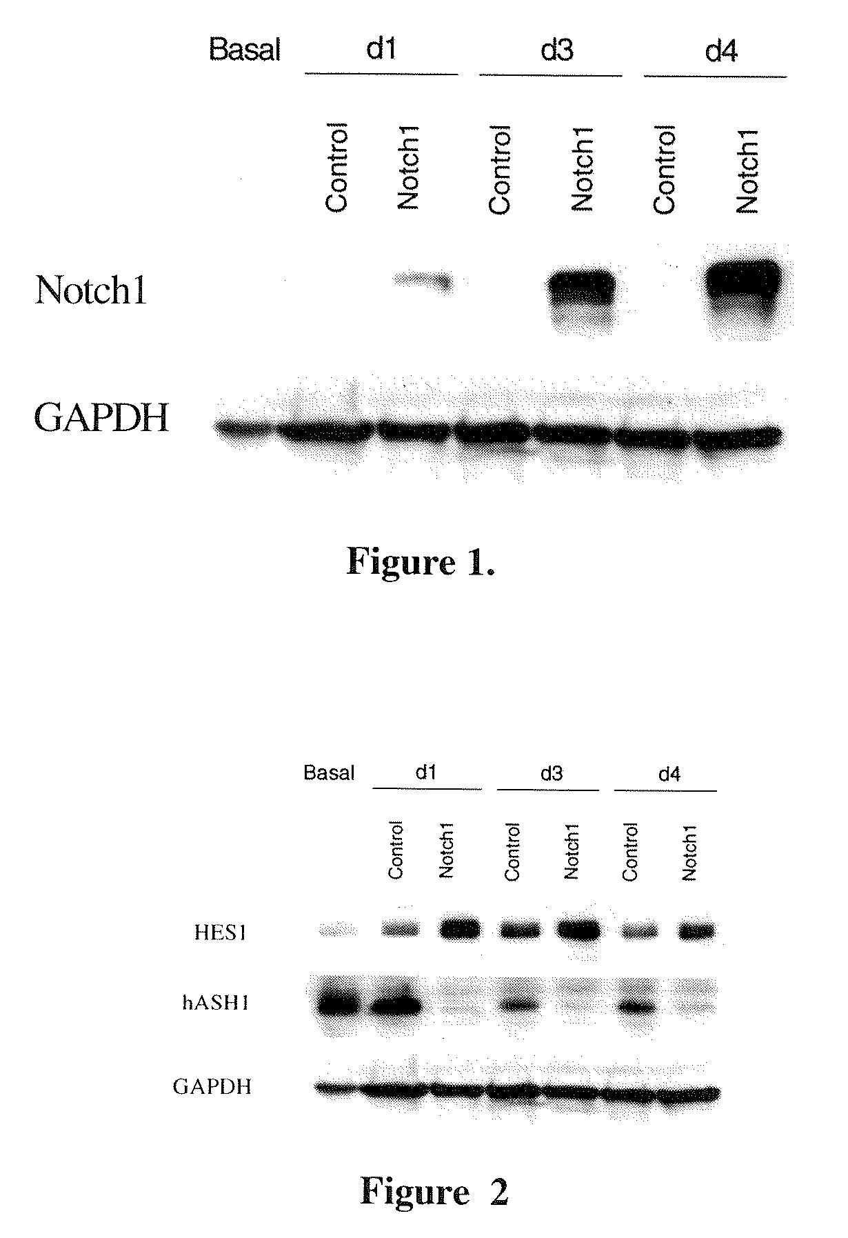 Modulating Notch1 Signaling Pathway for Treating Neuroendocrine Tumors